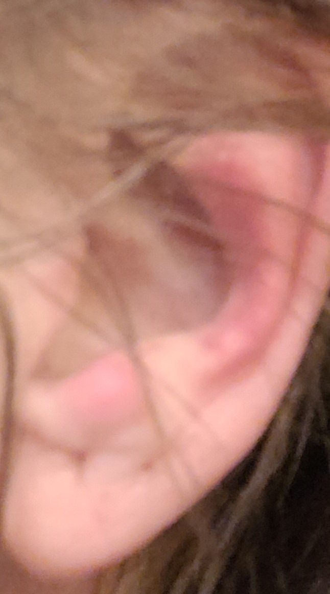 DefenderShield Over-Ear Air Tube Headphones E M F Free – Wired Design for Reduced Wireless Signal Contact – Built-in Mic & Audio Controls – Foldable Airtube Headphones E M F Free with Travel Case - Customer Photo 1