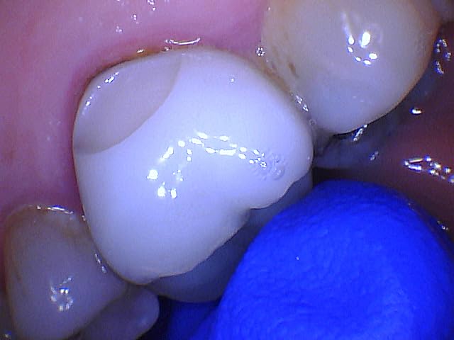 DY-50 Intraoral Camera Dental Camera Super Clear Button Driver Included Work W/Eaglesoft Dexis More customer photo 1