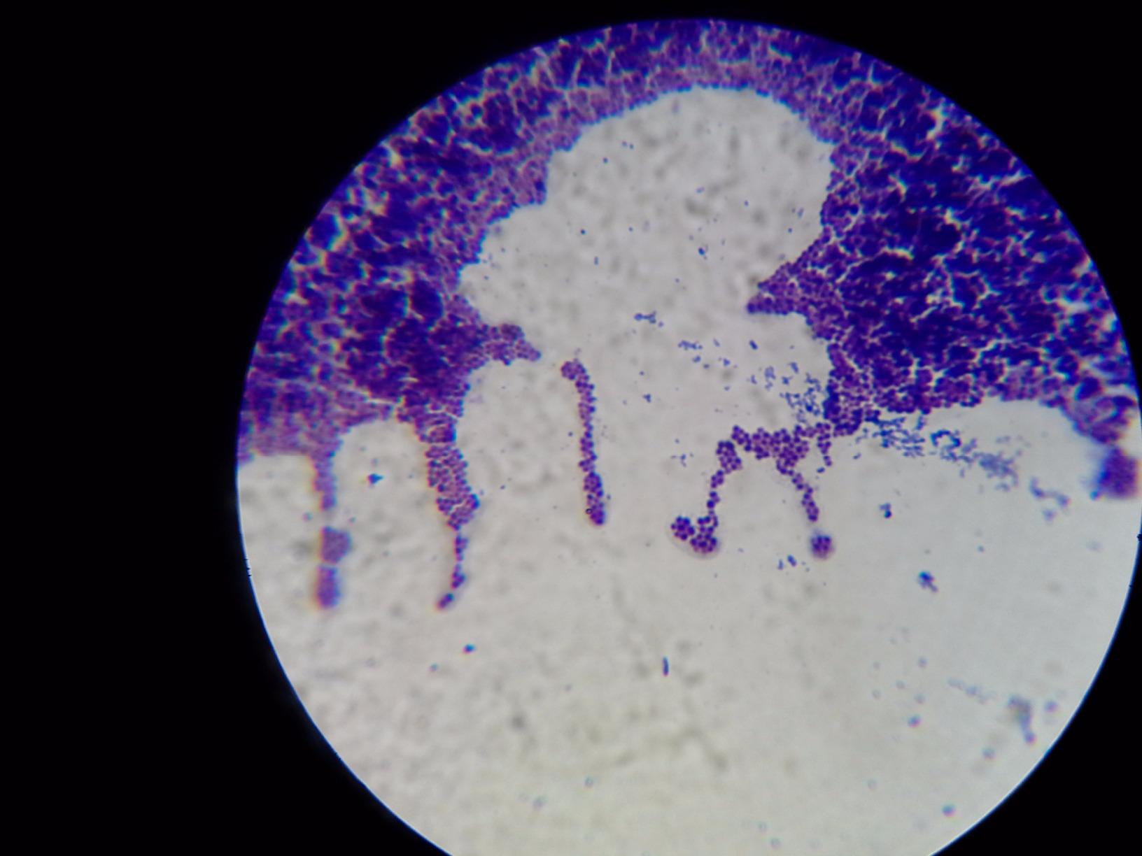 OMAX 40X-2000X LED Binocular Compound Lab Microscope w/ Double Layer Mechanical Stage + Blank Slides, Cover Slips, & Lens Cleaning Paper, M82ES-SC100-LP100 customer photo 1