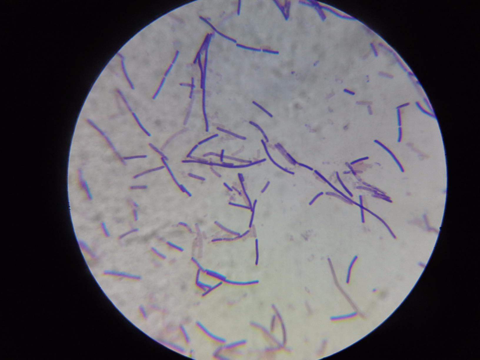 OMAX 40X-2000X LED Binocular Compound Lab Microscope w/ Double Layer Mechanical Stage + Blank Slides, Cover Slips, & Lens Cleaning Paper, M82ES-SC100-LP100 customer photo 2