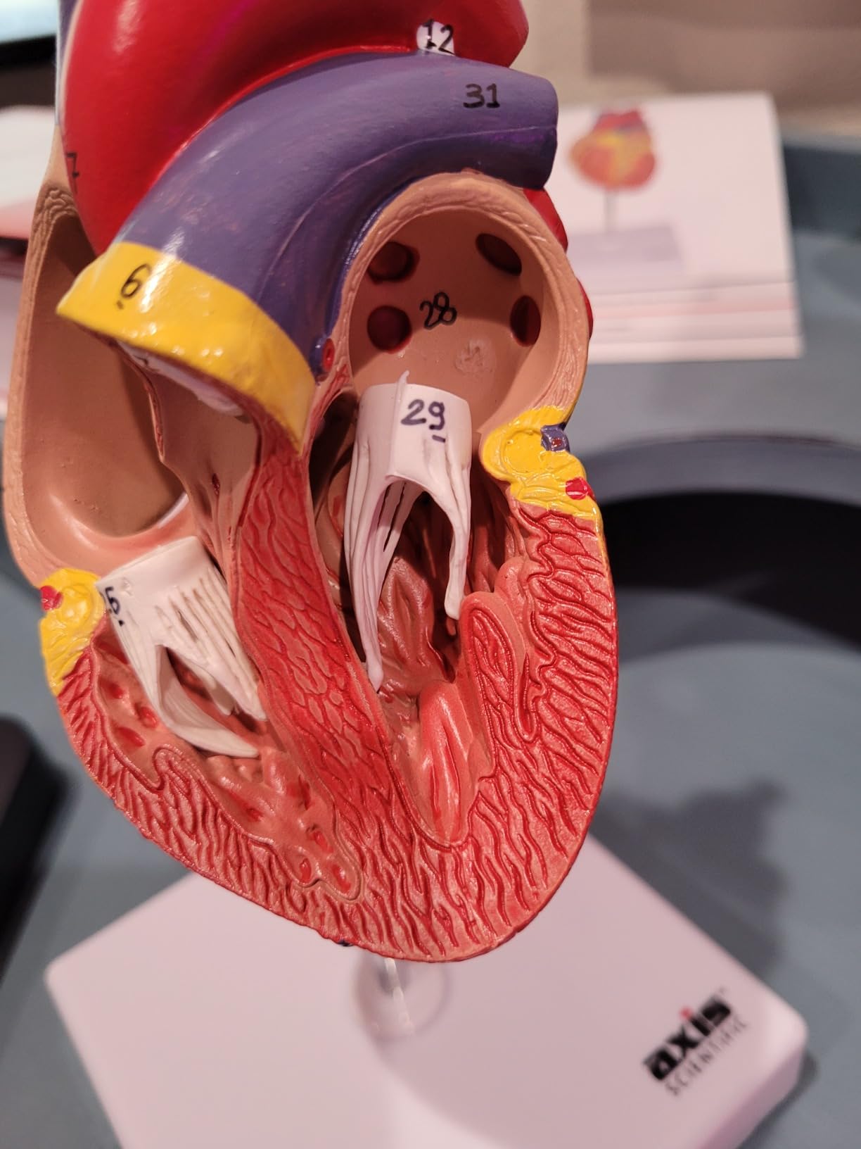 Axis Scientific Life-Size Human Heart Model, 2-Part Magnetic Design with 34 Clearly Labeled Internal Structures, Mounted on Base, Includes Anatomy Study Manual for Medical and Educational Use customer photo 1