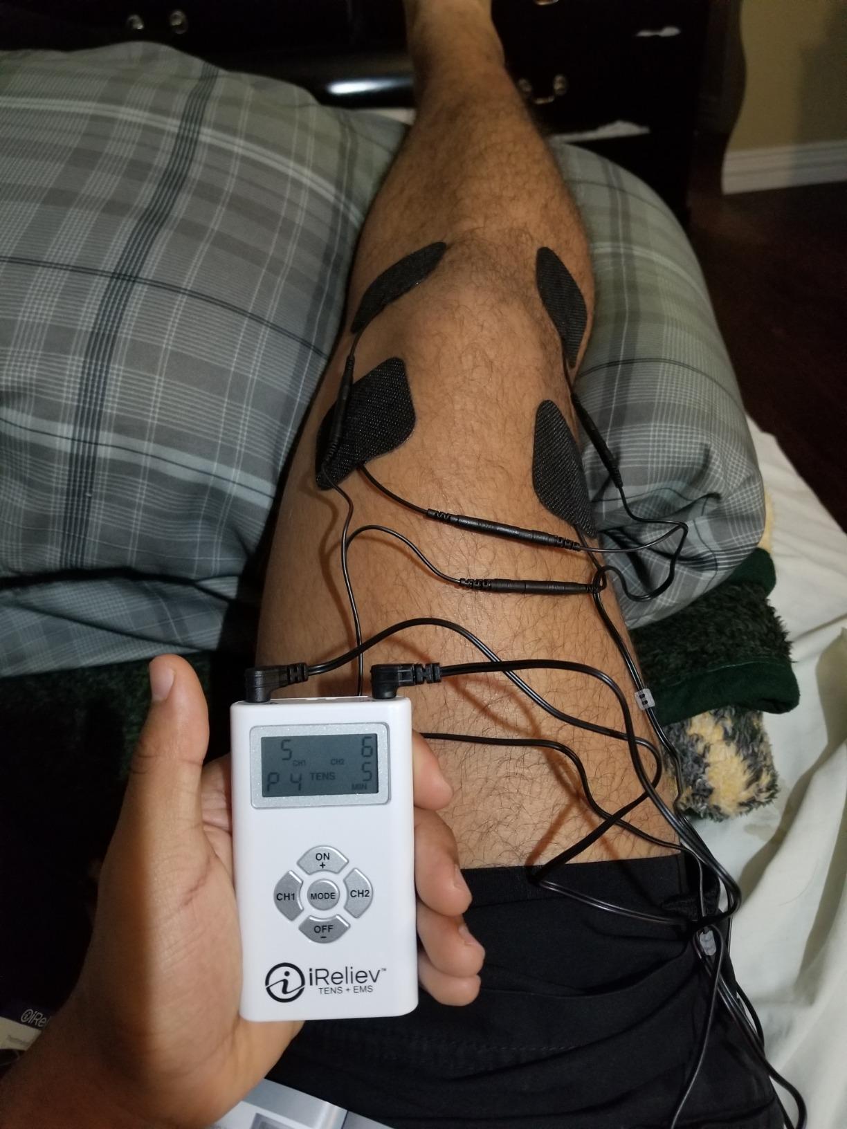 iReliev TENS + EMS Combination Unit Muscle Stimulator for Pain Relief, Arthritis, Muscle Strength - Treats Tired, Sore Muscles in Your Shoulders, Back, Ab's, Legs, Knee's, More customer photo 2