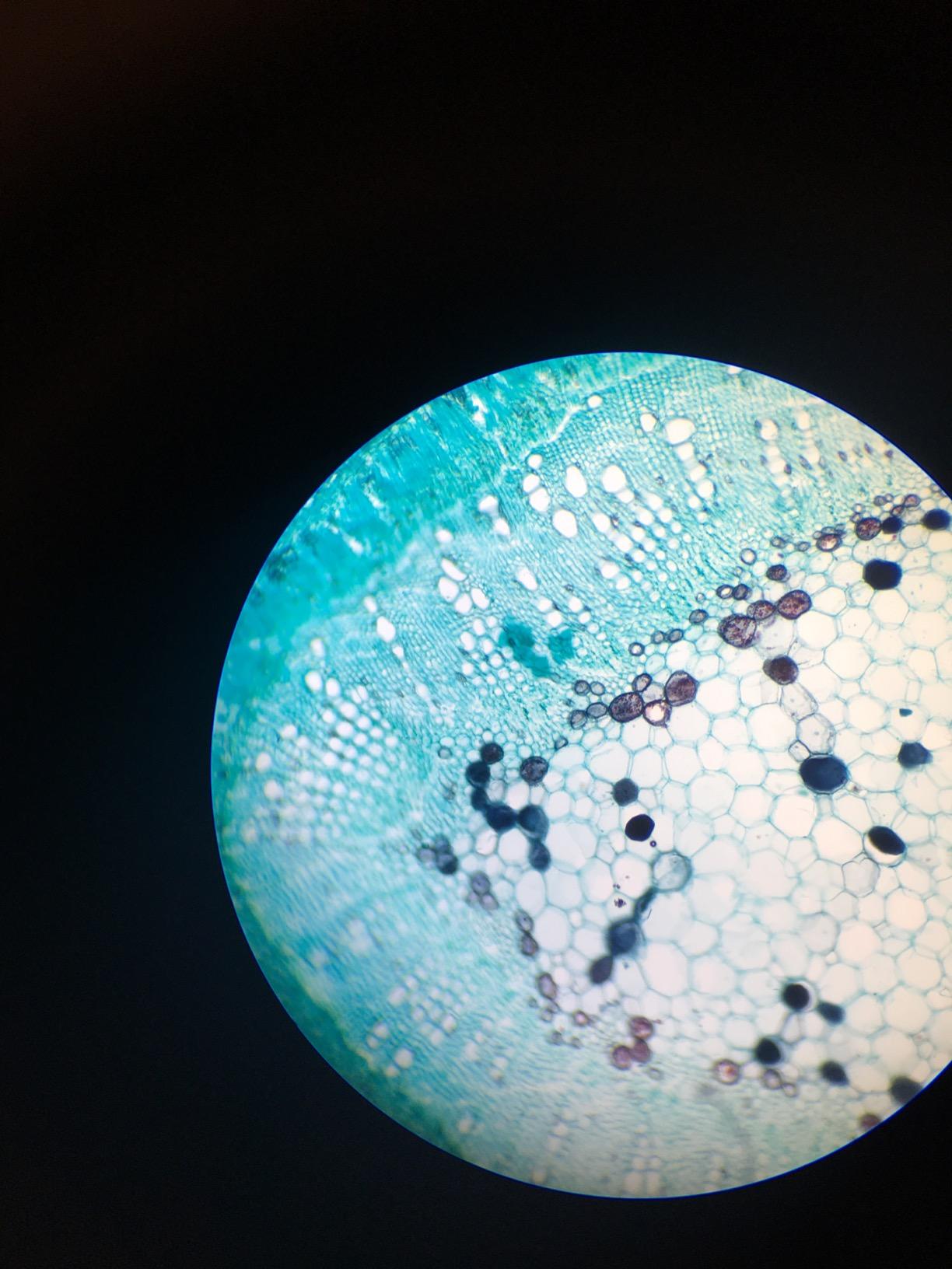 SWIFT SW350B 40X-2500X Magnification, Siedentopf Binocular Head, Research-Grade Compound Lab Microscope with Wide-Field 10X and 25X Eyepieces, Mechanical Stage, Abbe Condenser customer photo 1