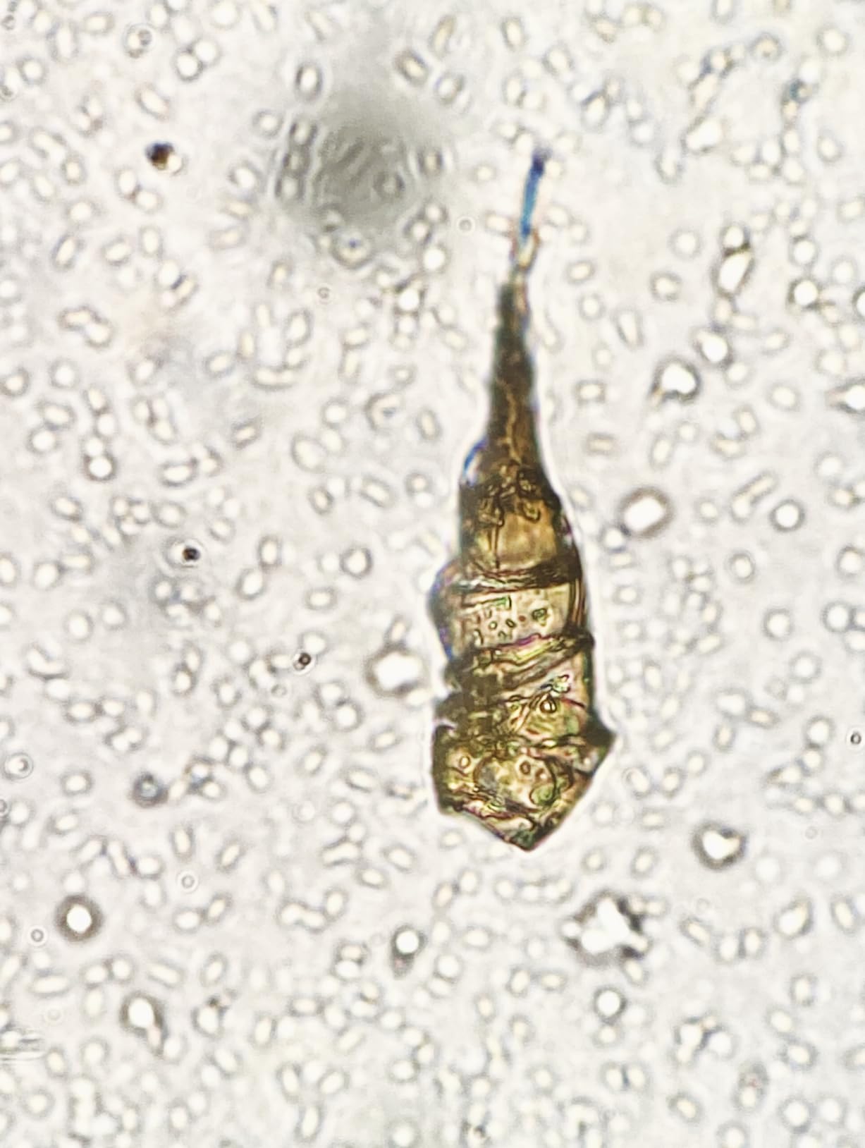 Swift SW380T 40X-2500X Magnification, Siedentopf Head, Research-Grade Trinocular Microscope Compound Lab with Wide-Field 10X/25X Eyepieces, Mechanical Stage, Ultra-Precise Focusing, Camera-Compatible customer photo 1