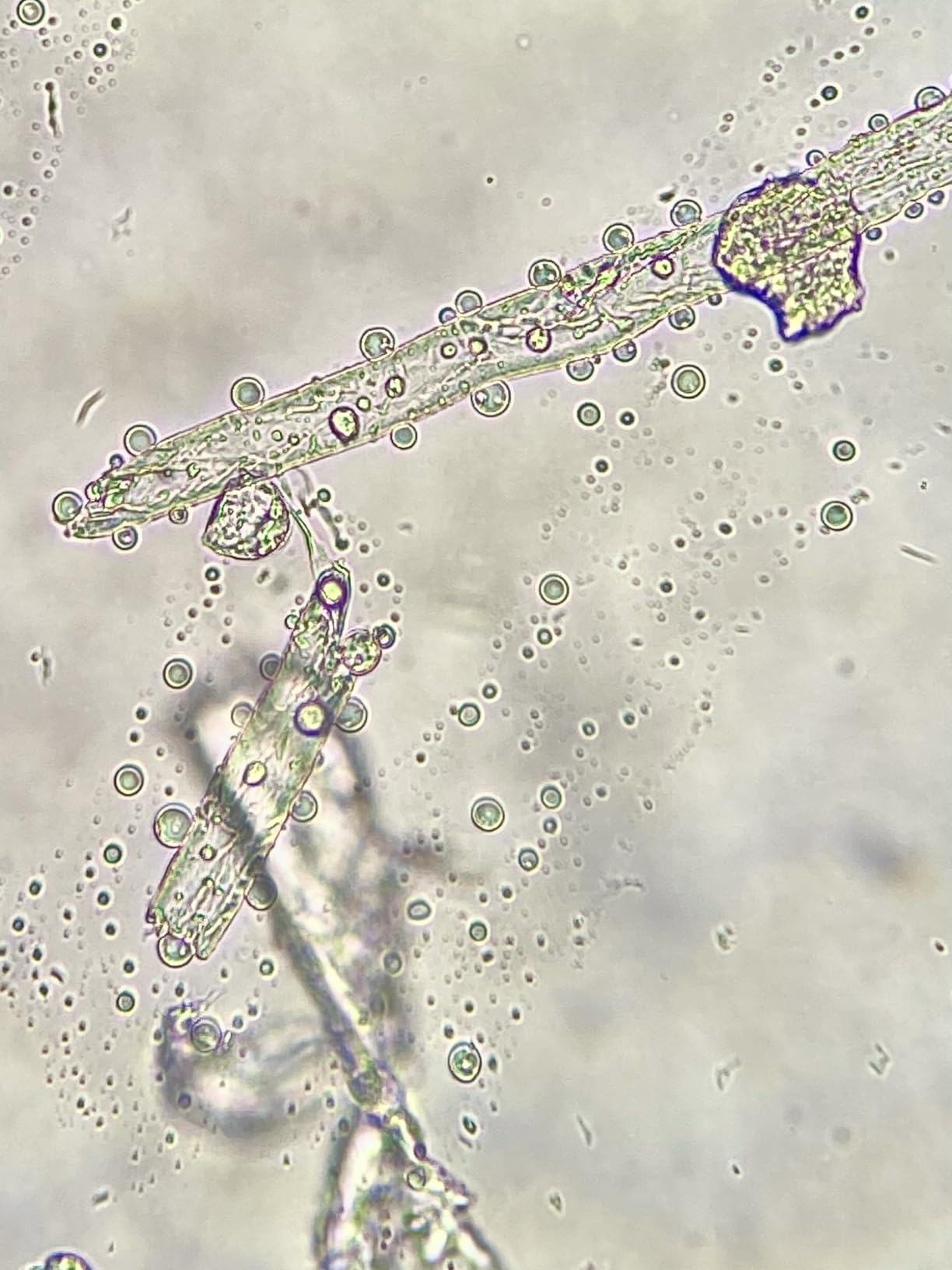 Swift SW380T 40X-2500X Magnification, Siedentopf Head, Research-Grade Trinocular Microscope Compound Lab with Wide-Field 10X/25X Eyepieces, Mechanical Stage, Ultra-Precise Focusing, Camera-Compatible customer photo 2