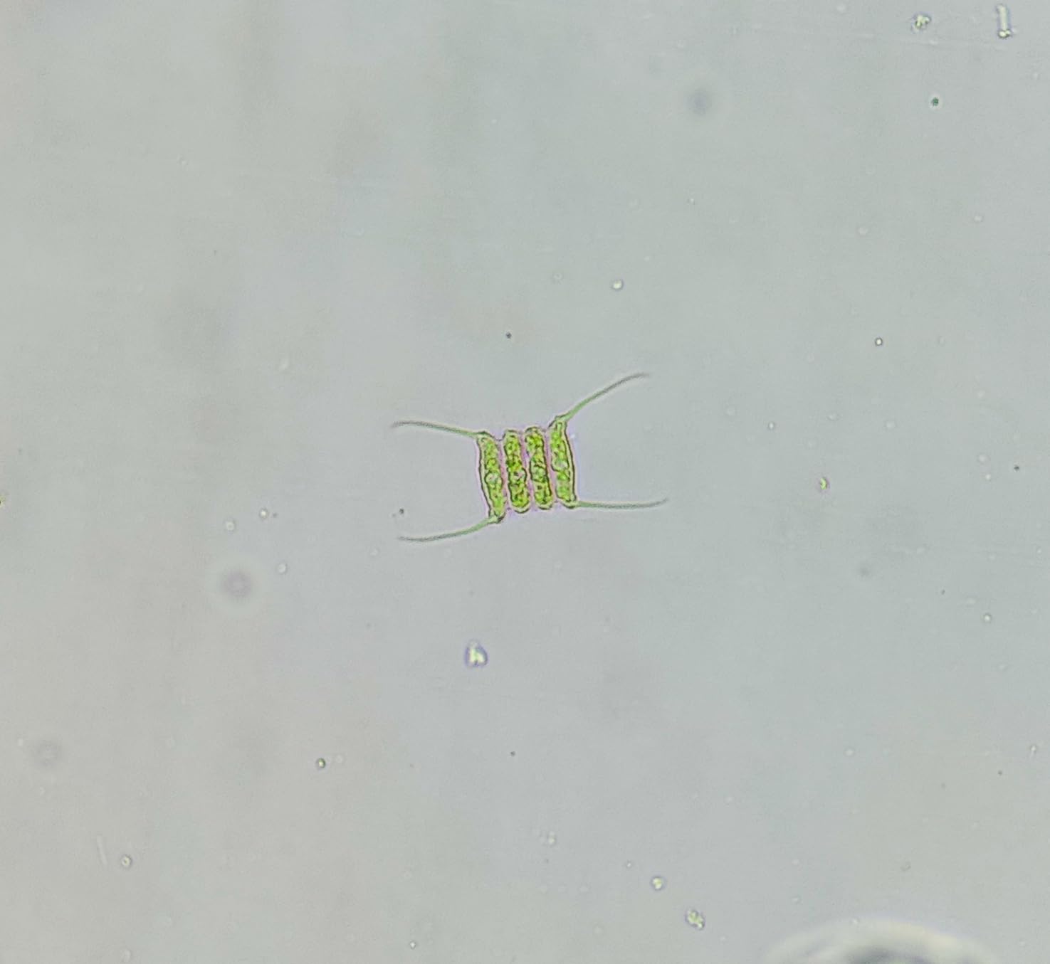 SWIFT SW380B 40X-2500X Magnification, Siedentopf Head, Research-Grade Binocular Compound Lab Microscope with Wide-Field 10X and 25X Eyepieces, Mechanical Stage, Ultra-Precise Focusing customer photo 1
