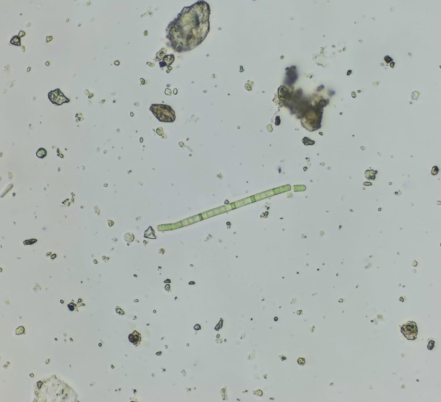 SWIFT SW380B 40X-2500X Magnification, Siedentopf Head, Research-Grade Binocular Compound Lab Microscope with Wide-Field 10X and 25X Eyepieces, Mechanical Stage, Ultra-Precise Focusing customer photo 2