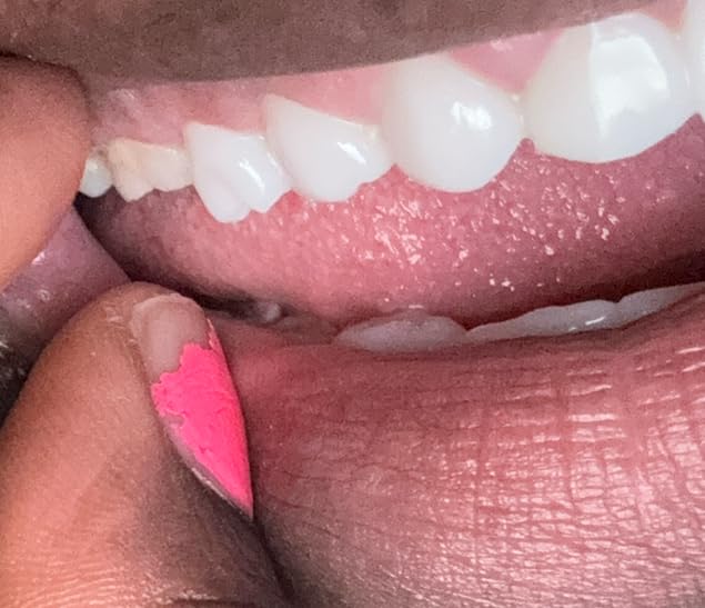 mastermedi Zinc Oxide Eugenol Cement Dental Care Kit Glue For Crowns & Bridges Filling customer photo 2