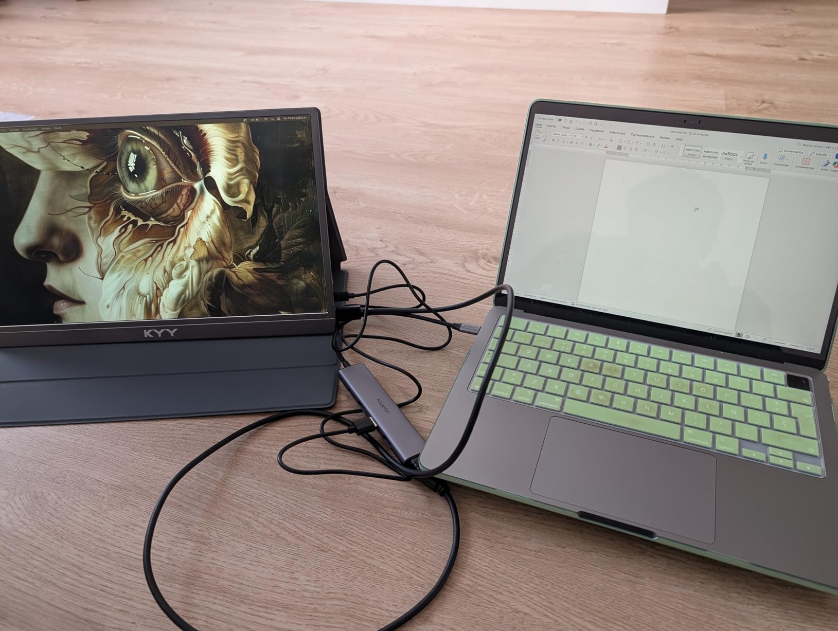 UGREEN USB C Hub 5 in 1 Multiport Adapter Revodok 105 4K HDMI, 100W Power Delivery, 3 USB-A Data Ports customer photo 1