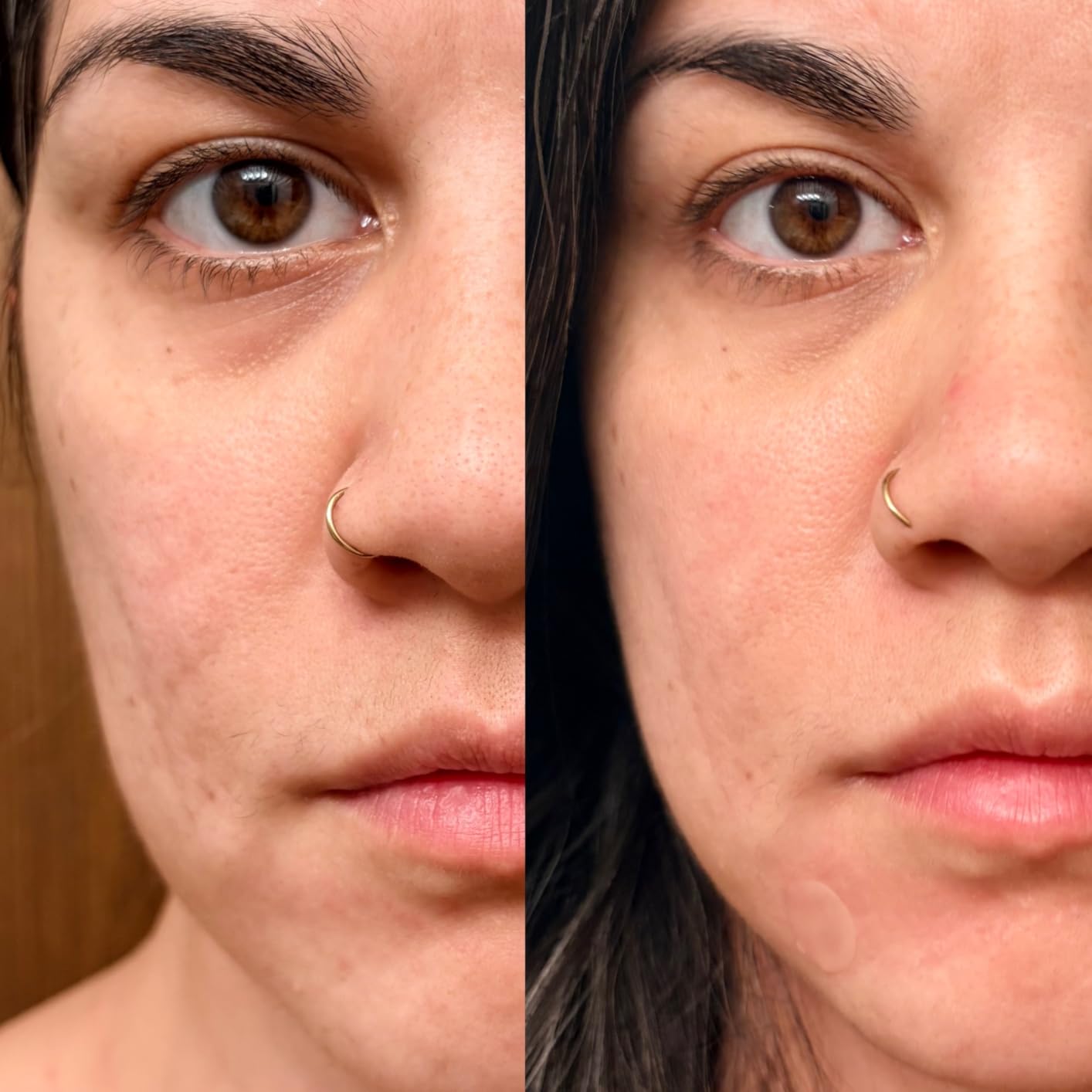 LifePro Red Light Therapy for Body Panel - 90 & 120 Dual Chip LEDs - 660nm & 850nm Near Infrared Full Body Red light Therapy Panel - For Daily Wellness & Comfort -Includes Hanging Kit and Eyewear customer photo 2