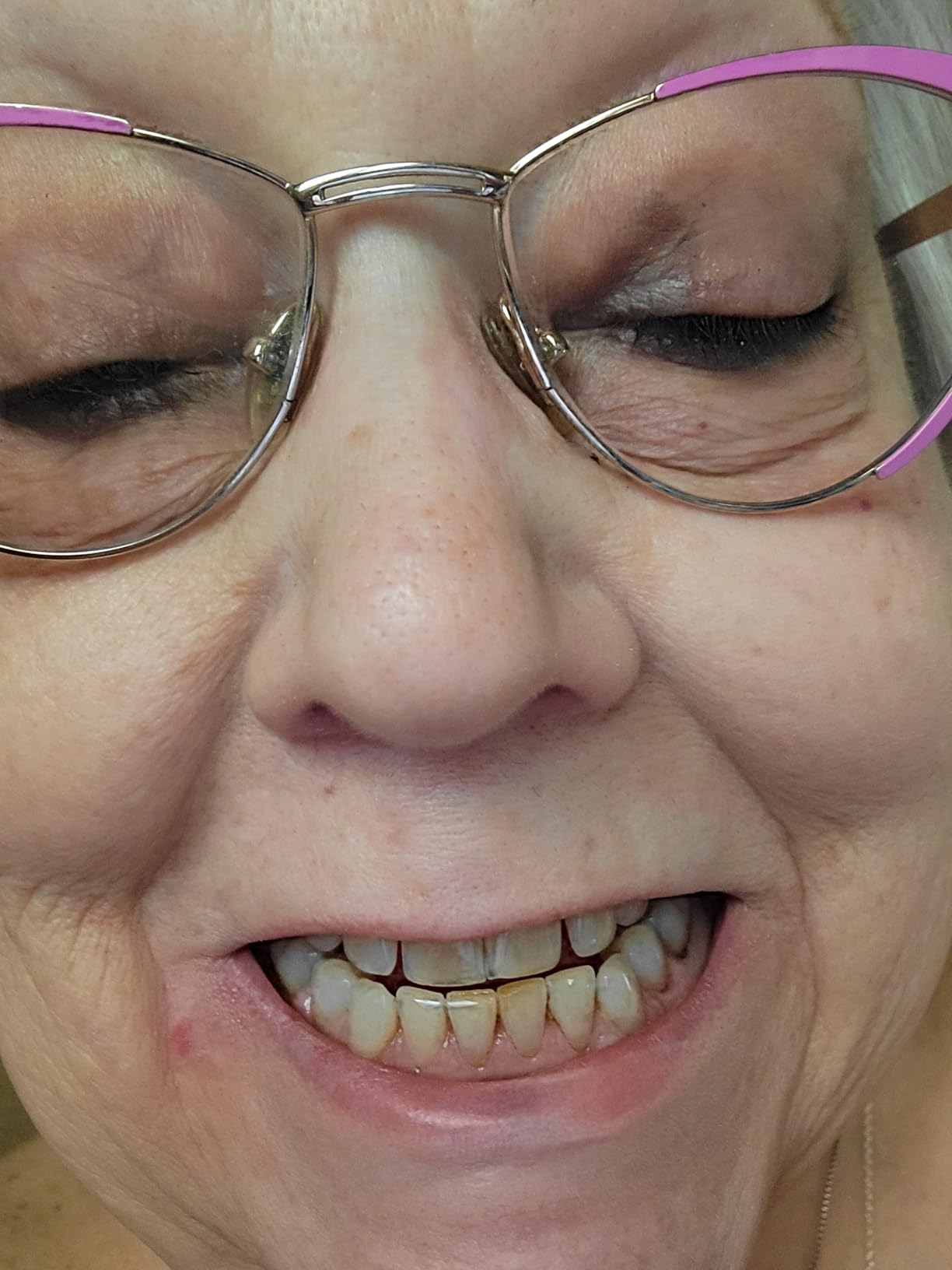 Plaque Remover for Teeth, Dental Cleaning Kit Tartar Remover for Teeth with LED Light & 5 Modes, Rechargeable Dental Cleaner, 4 Replaceable Heads customer photo 1