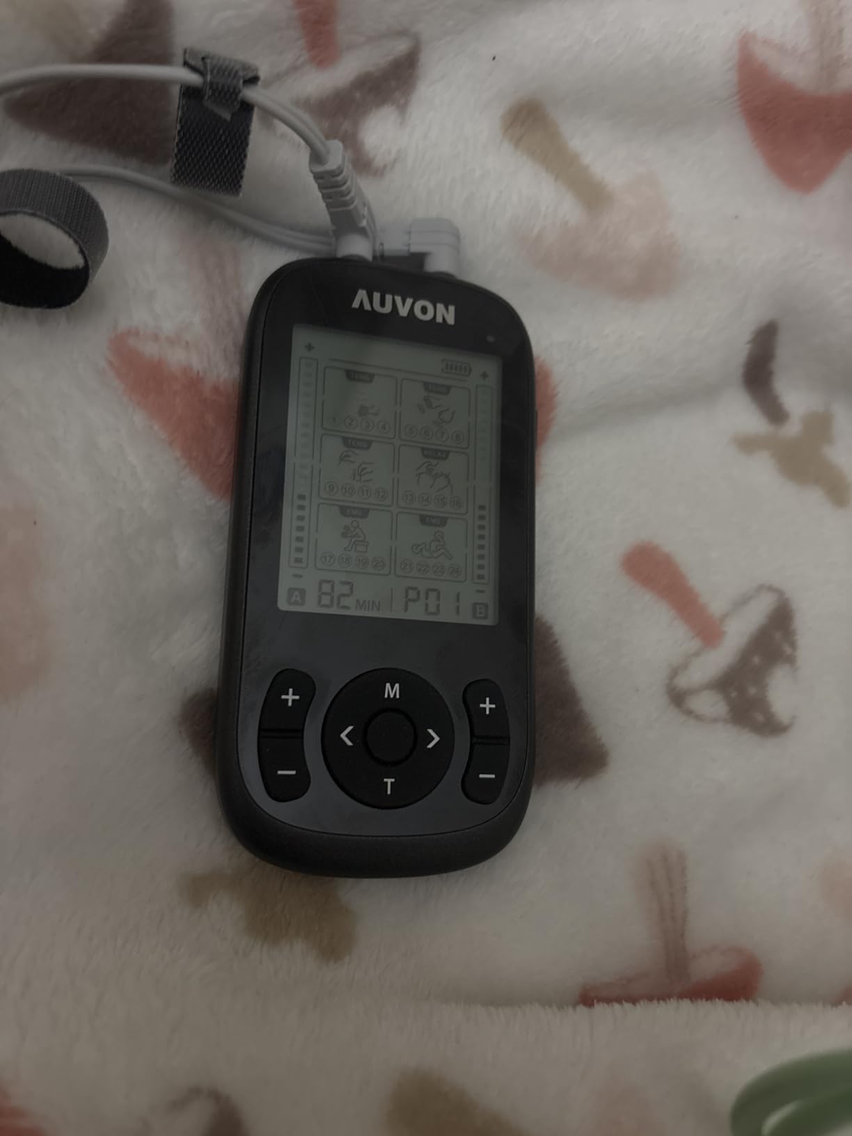 AUVON 3-in-1 TENS Unit Muscle Stimulator, EMS Massage Machine with 40 Intensities for Gradual Shoulder, Sciatica, Back Pain Relief, 24 Modes Rechargeable Electronic Pulse Massager with 12 TENS Pads customer photo 1