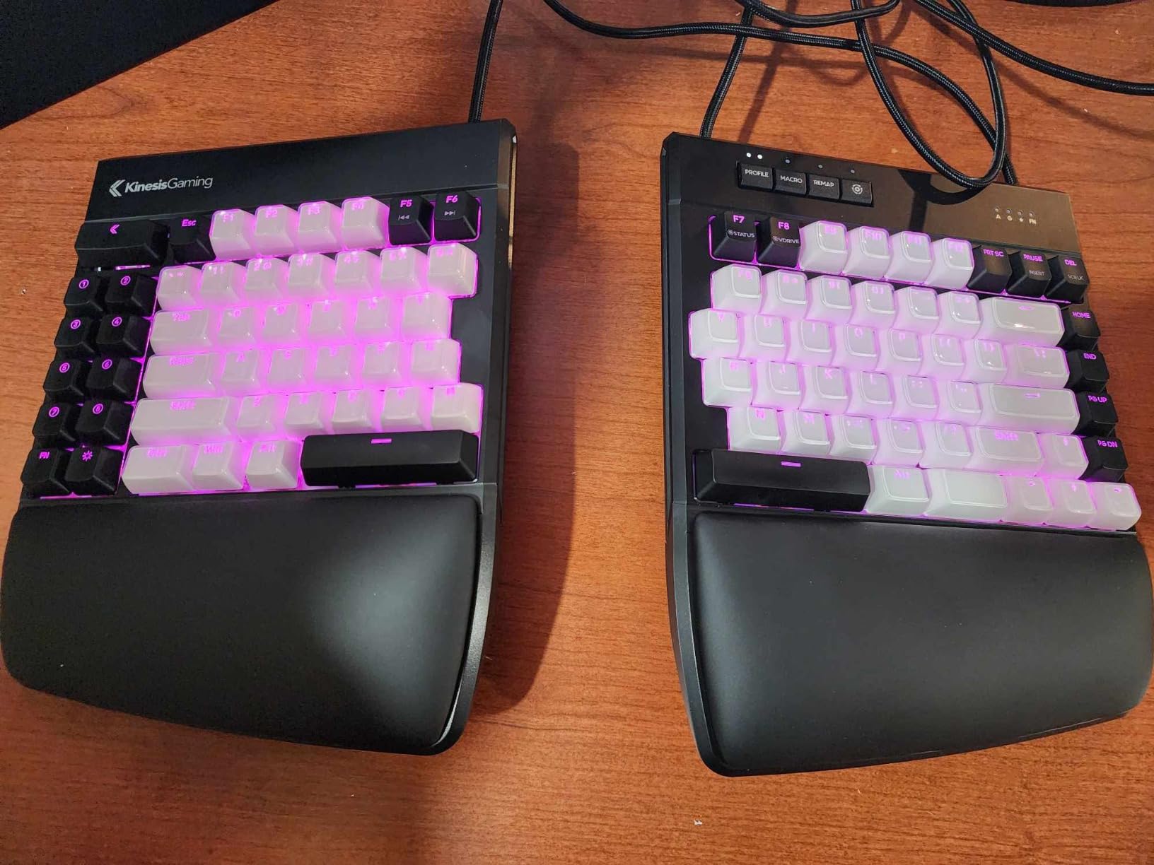 KINESIS Freestyle Edge RGB Plus Split Mechanical Keyboard | Hotswap Linear Switches | RGB | Ergonomic | Detachable Palm Support | Fully Programmable | Mac Keycaps Included | Lift Kit Included customer photo 1