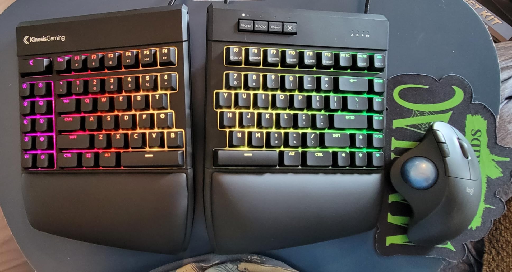 KINESIS Freestyle Edge RGB Plus Split Mechanical Keyboard | Hotswap Linear Switches | RGB | Ergonomic | Detachable Palm Support | Fully Programmable | Mac Keycaps Included | Lift Kit Included customer photo 2