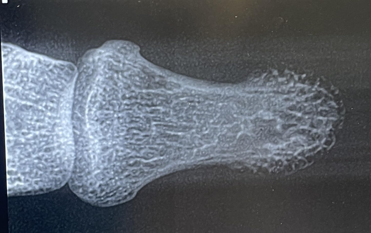 Handheld Dental Xray Machine Portable, Digital Intraoral X-Ray Sensor System for Dental Veterinary Clinic customer photo 2