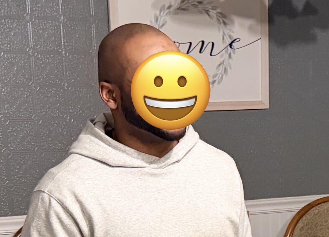 Wahl Professional 5 Star Balding Clipper, Corded V5000 Electromagnetic Motor, for Ultra-Close Trimming customer photo 1