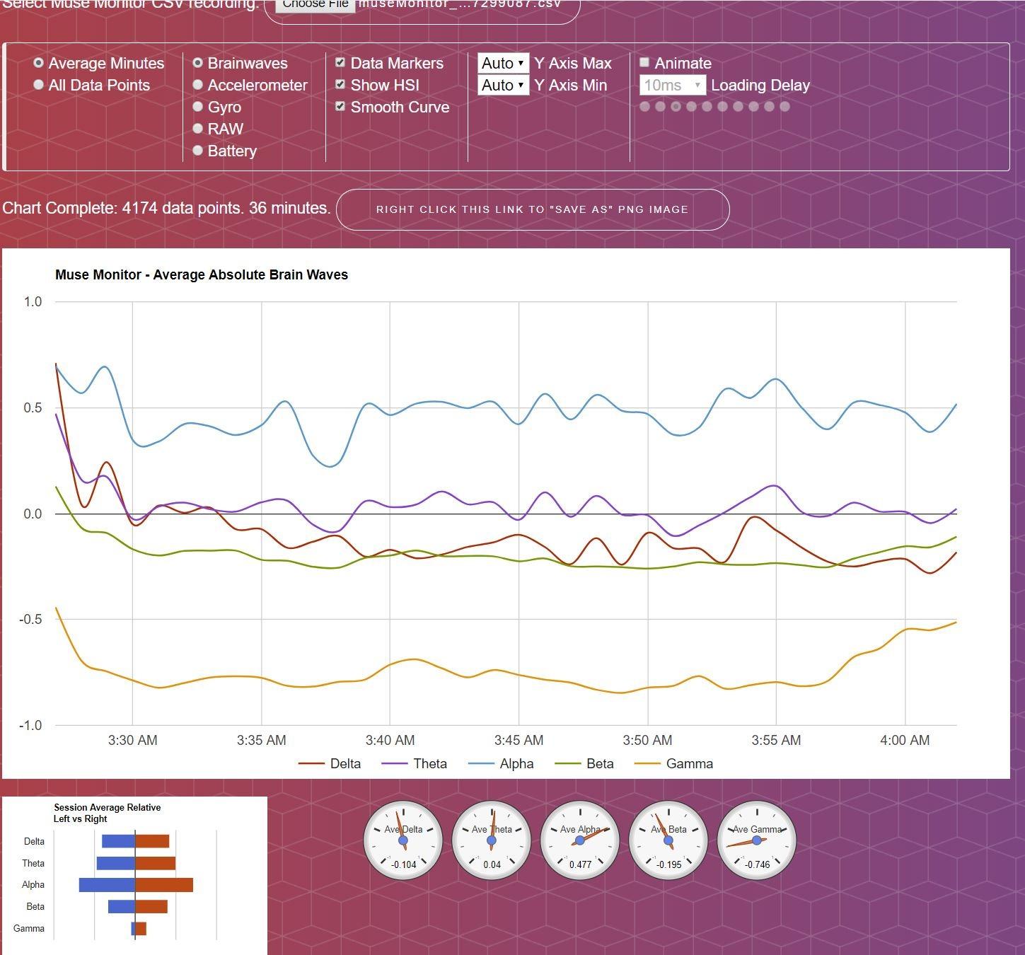 Muse: The Brain Sensing Headband customer photo 1
