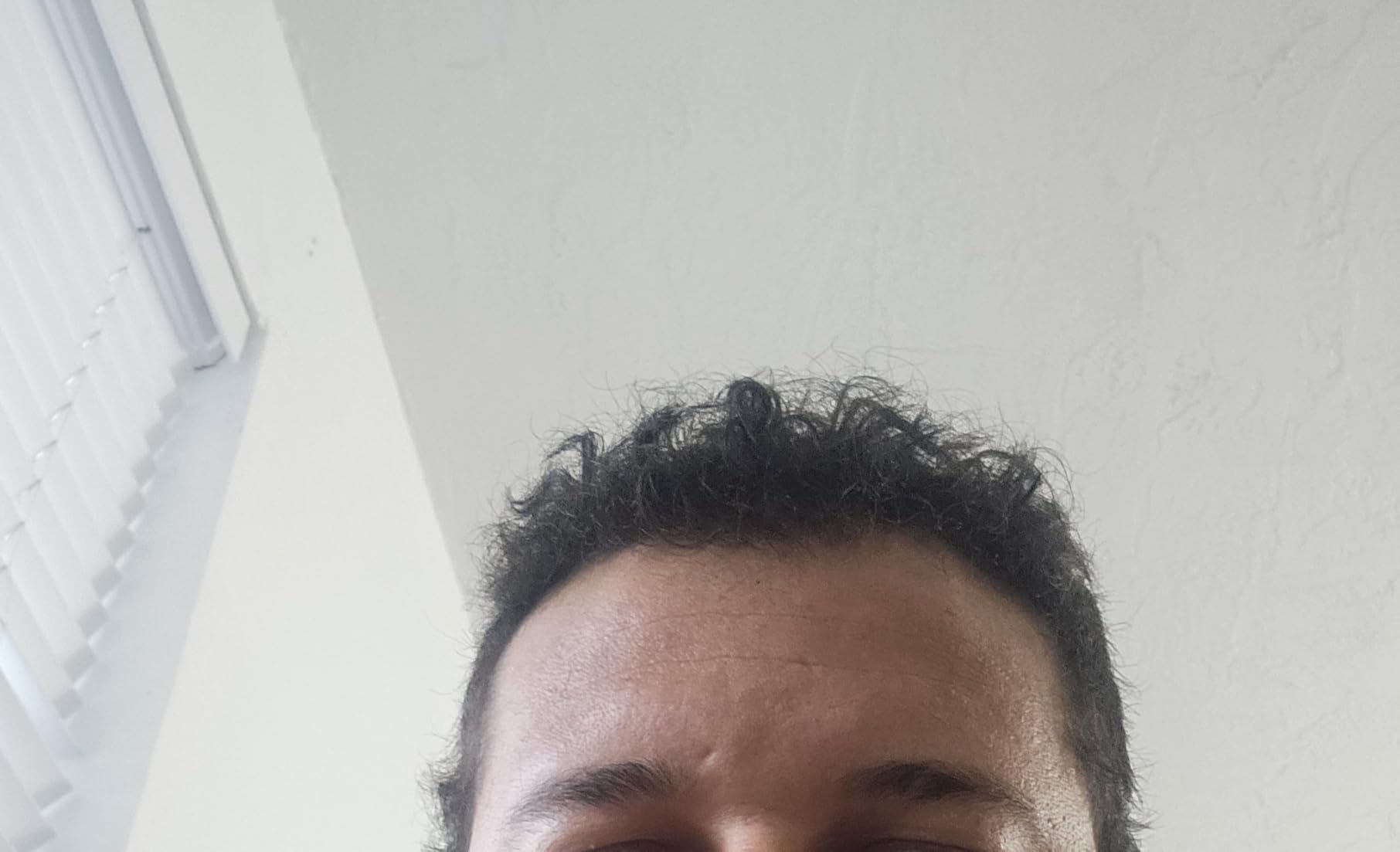 iRestore Essential - Laser Red Light Therapy for Hair Growth - FDA Cleared Hair Loss, Hair Thinning & Alopecia Treatment for Men & Women - Laser Cap for Hair Regrowth Stimulate Denser Fuller Hair customer photo 2