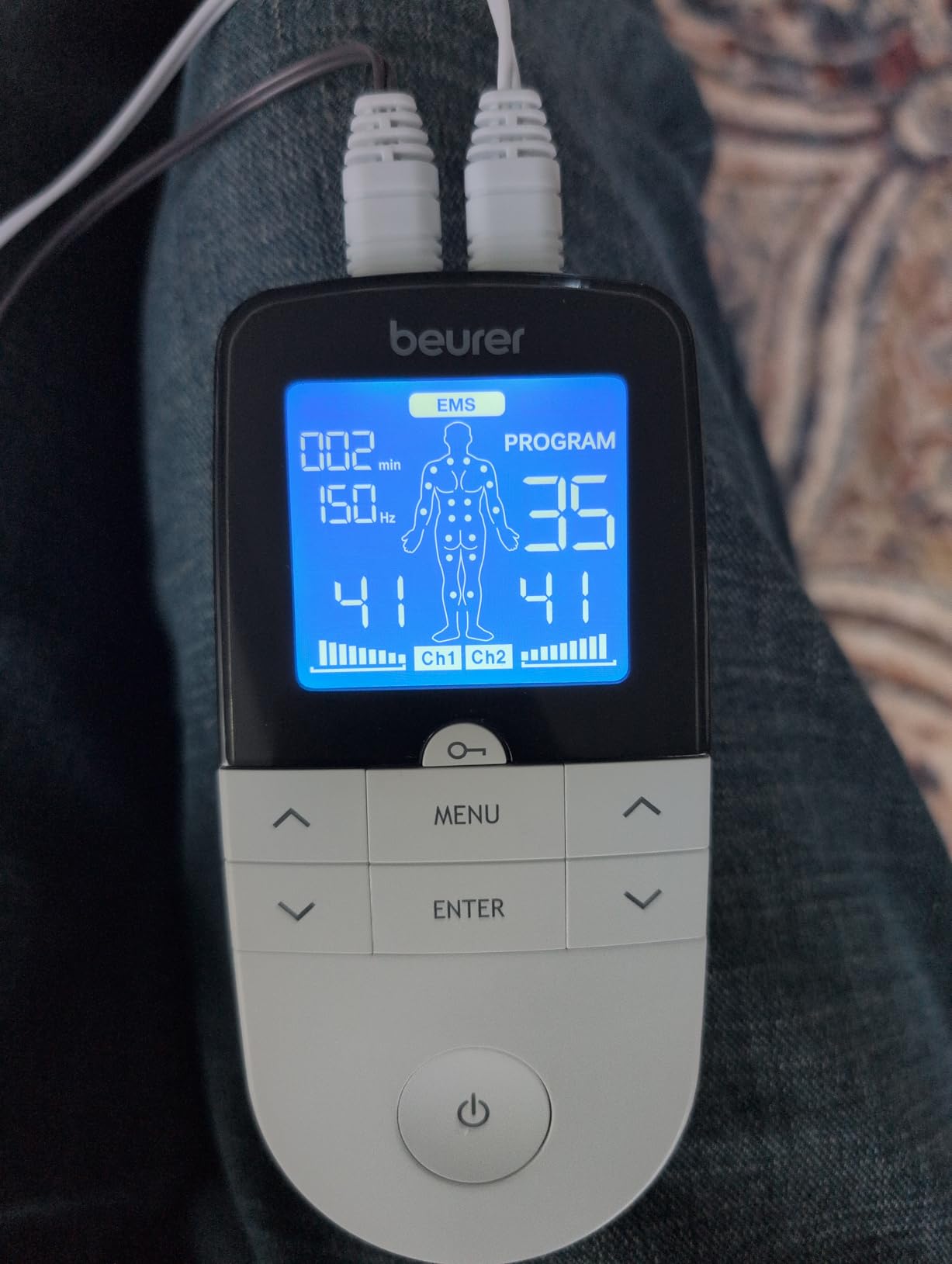 Beurer EM49 Digital TENS & EMS Device for Pain Relief and Muscle Stimulation, 15 TENS Programs, 35 EMS Programs, 2 Adjustable Channels with 4 Self-Adhesive Electrodes customer photo 1