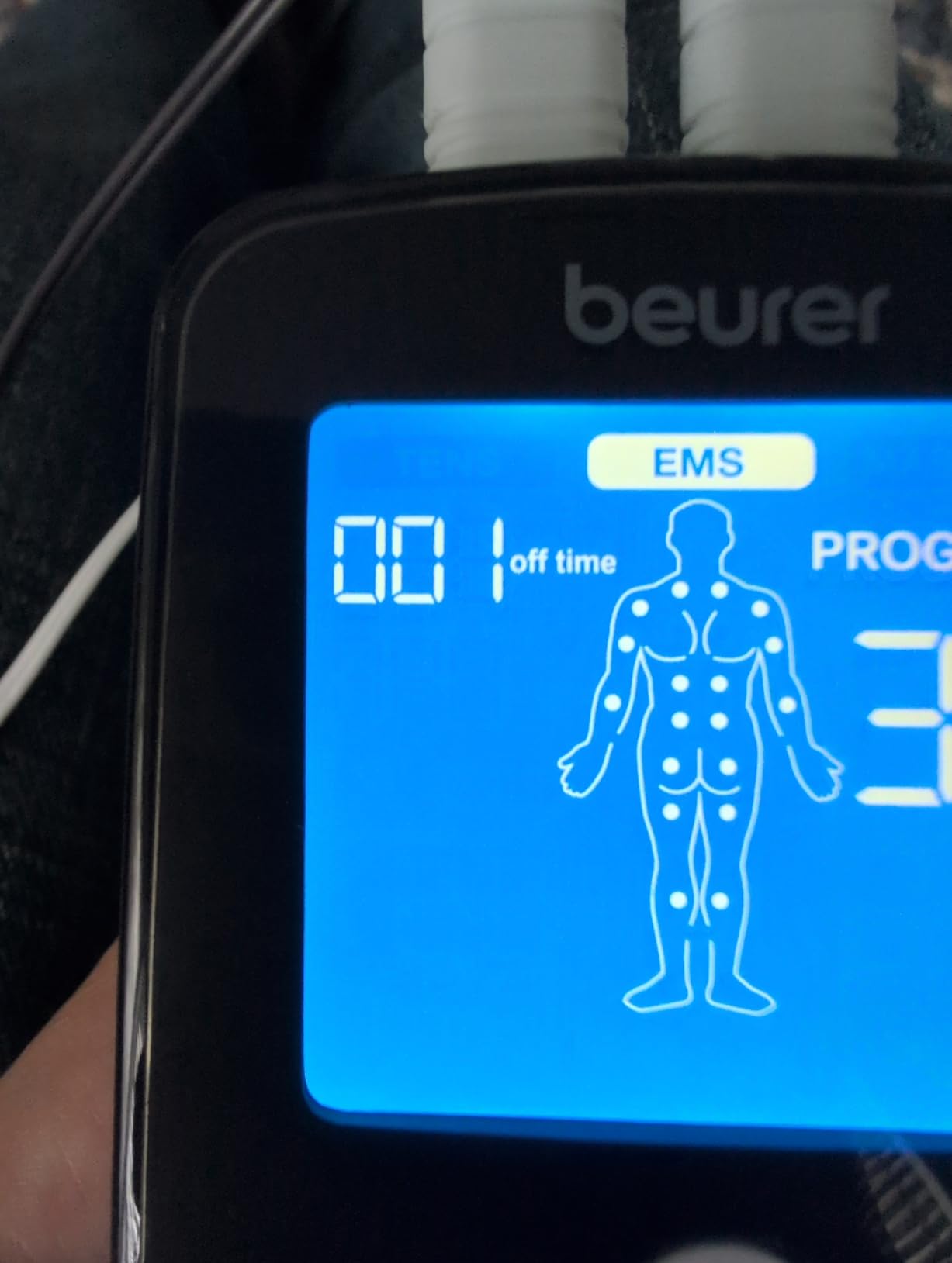 Beurer EM49 Digital TENS & EMS Device for Pain Relief and Muscle Stimulation, 15 TENS Programs, 35 EMS Programs, 2 Adjustable Channels with 4 Self-Adhesive Electrodes customer photo 2