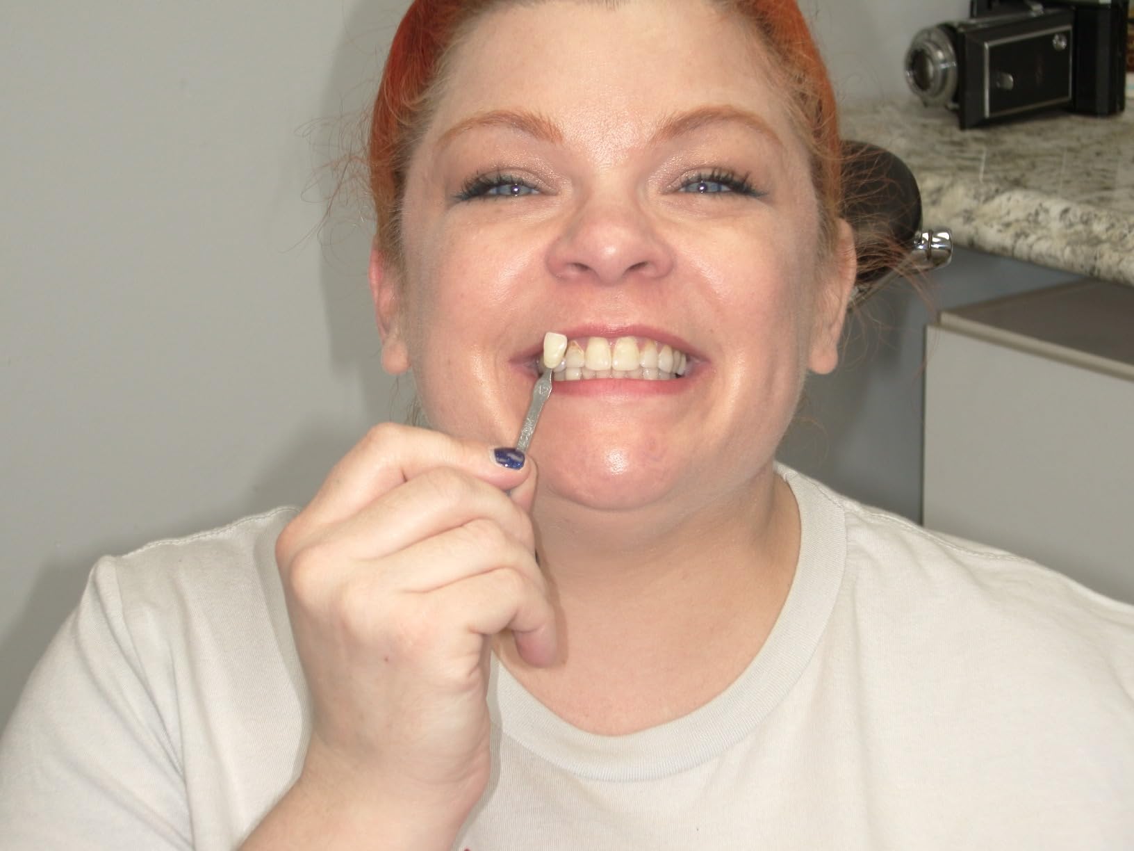 SNOW Diamond Wired Whitening Kit - Sensitive Teeth Whitening Kit - Whitens & Repairs Teeth customer photo 1