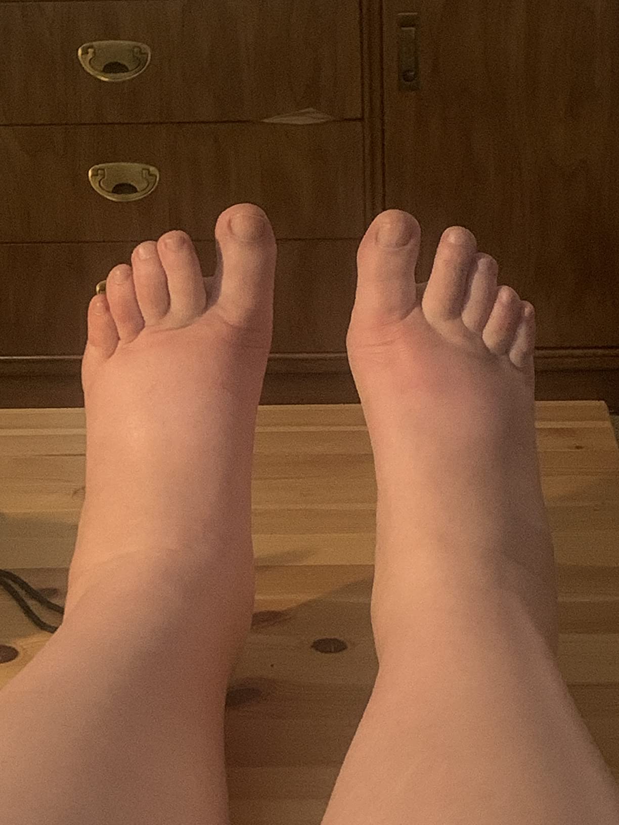 RENPHO Foot Massager Machine with Heat, Shiatsu Foot Massager for Plantar Fasciitis, Birthday Gifts for Women, Cordless Control, FSA Eligible HSA Store Eligible, Up to Size 13 customer photo 2