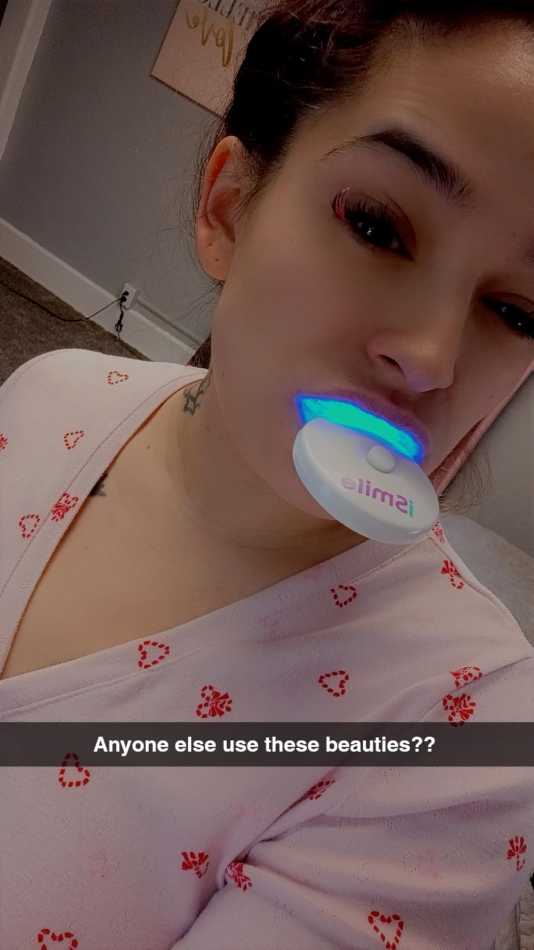 iSmile Teeth Whitening Kit - LED Light, 35% Carbamide Peroxide, (3) 3ml Gel Syringes customer photo 1