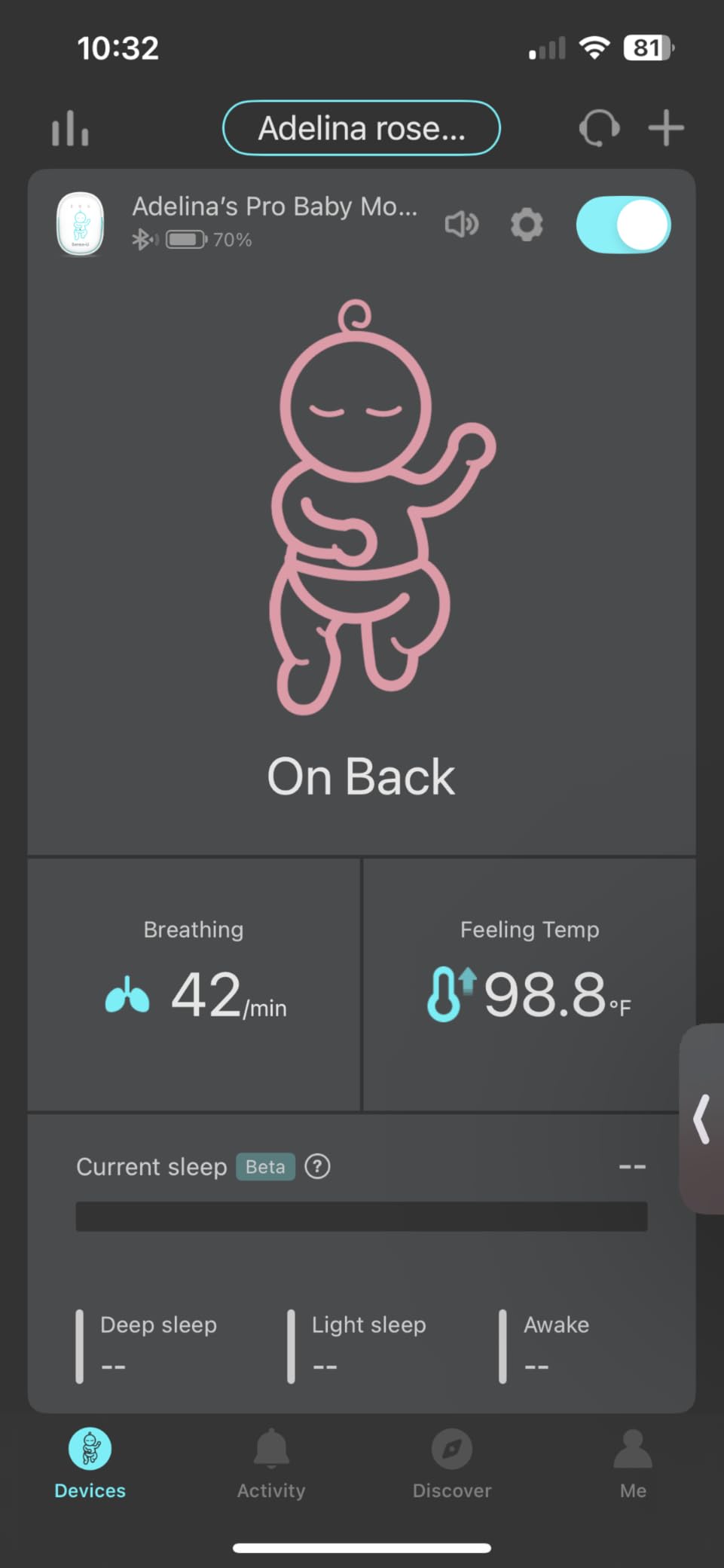 Sense-U Pro Baby Monitor - Breathing Movement, Rollover & Overheating Trackers for Better Sleep, Simple Clip-On Smart Sleep Monitor with Arousal Vibration, Audible Alerts & Sleep Analysis customer photo 1