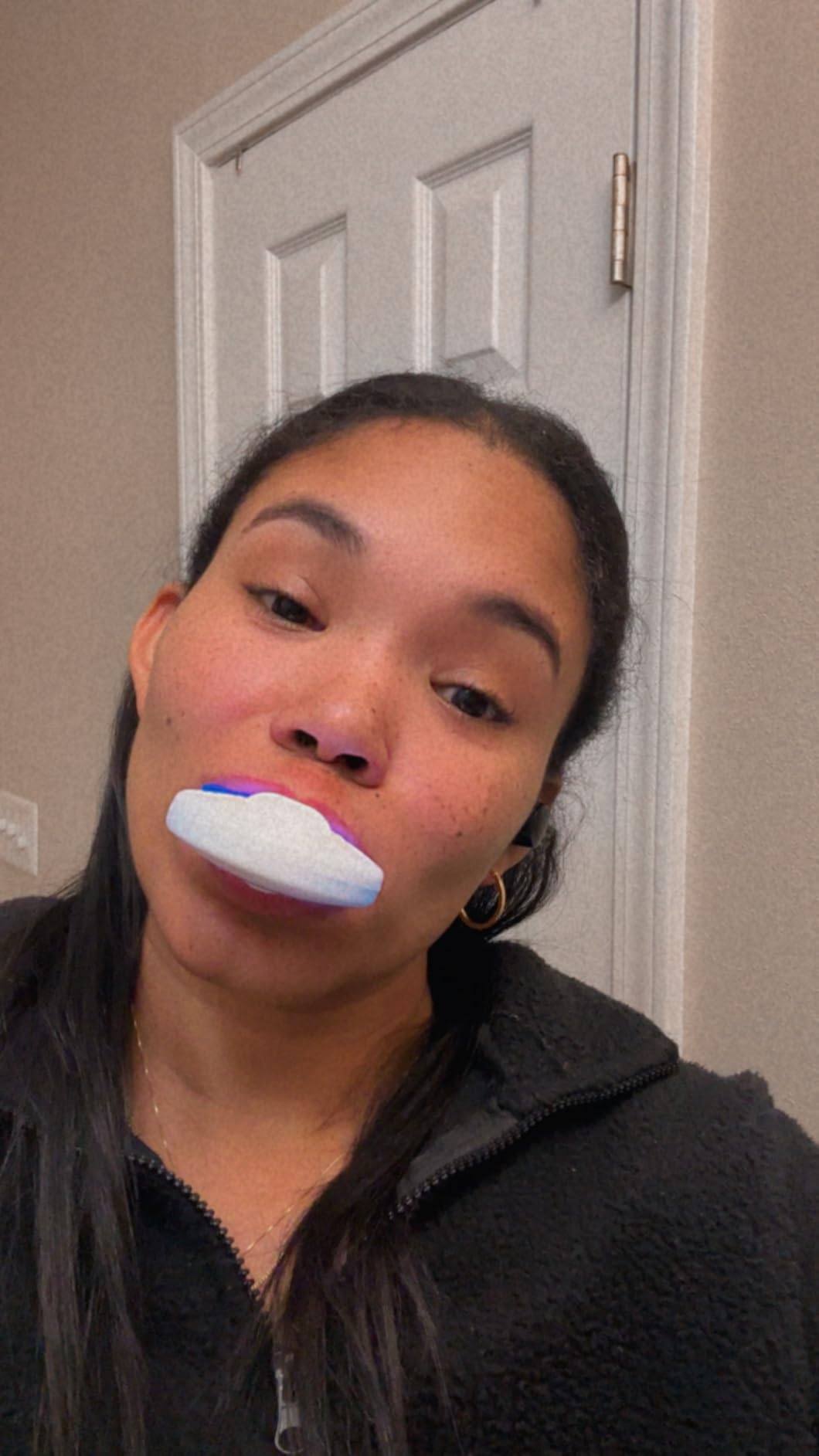 MySmile Teeth Whitening Kit with LED Light, 10 Min Non-Sensitive Fast Teeth Whitener customer photo 2