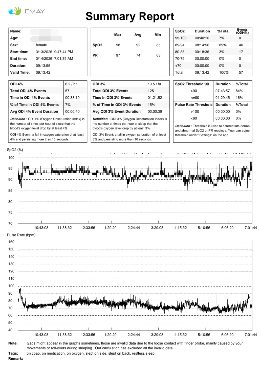 SleepO2 Wrist Recording Pulse Oximeter by EMAY | Continuous Pulse Oximeter to Record Blood Oxygen Saturation and Pulse Rate Overnight | Export Sleep Report & Raw Data customer photo 1