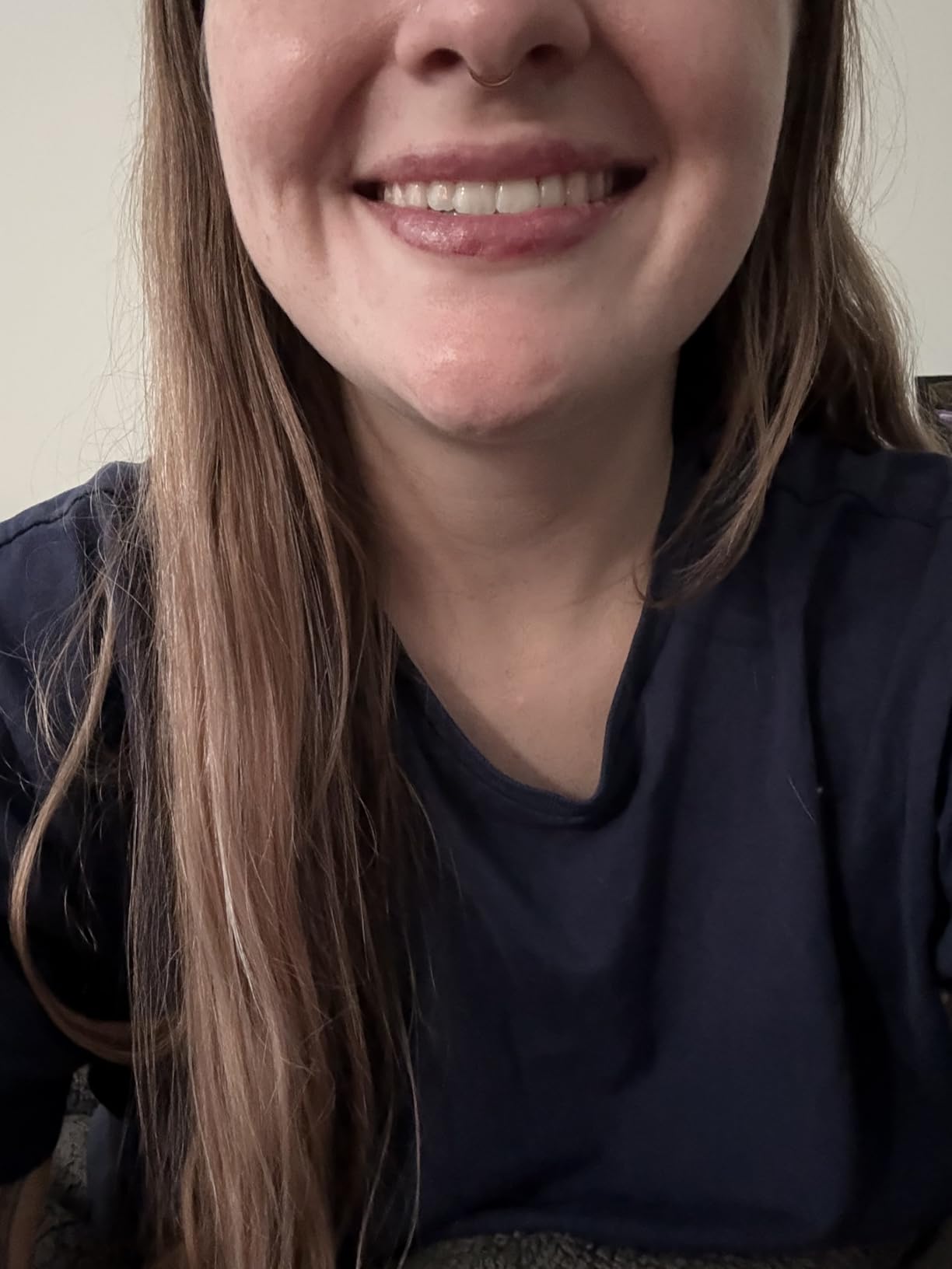 Crest 3D Whitestrips Professional Effects + LED Light - Teeth Whitening Kit, 1 Light + 20 Treatments customer photo 1