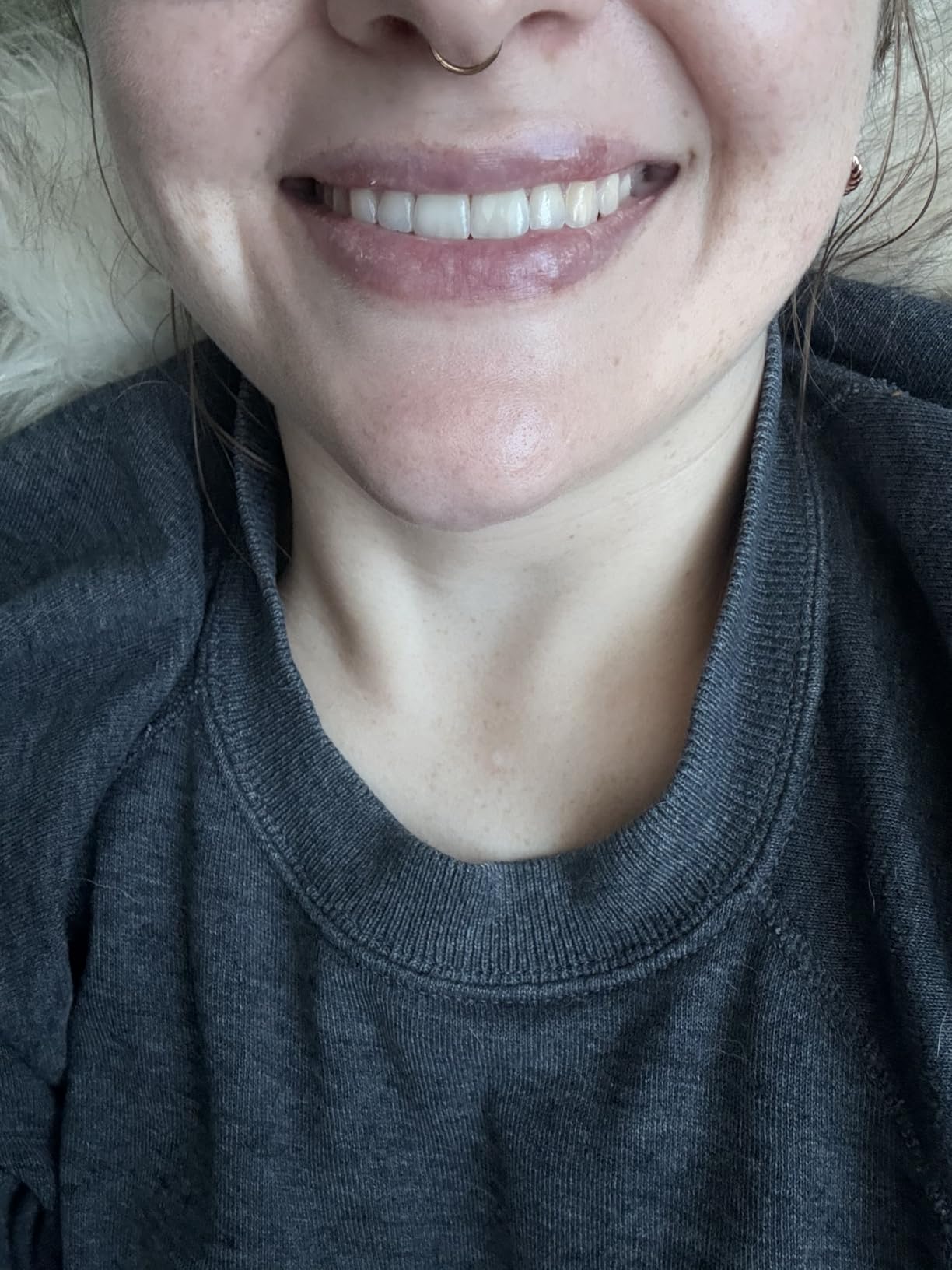 Crest 3D Whitestrips Professional Effects + LED Light - Teeth Whitening Kit, 1 Light + 20 Treatments customer photo 2