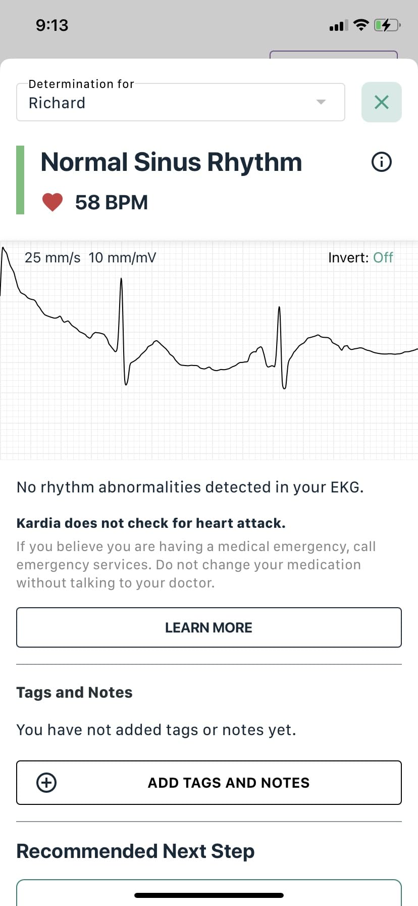 KardiaMobile Card Credit-Card Sized EKG, Medical-Grade & FDA-Cleared Personal Heart Monitor, Bluetooth Enabled, On-The-Go Check-Up Anywhere, Compatible with Most Smartphones, No Subscription Required customer photo 2