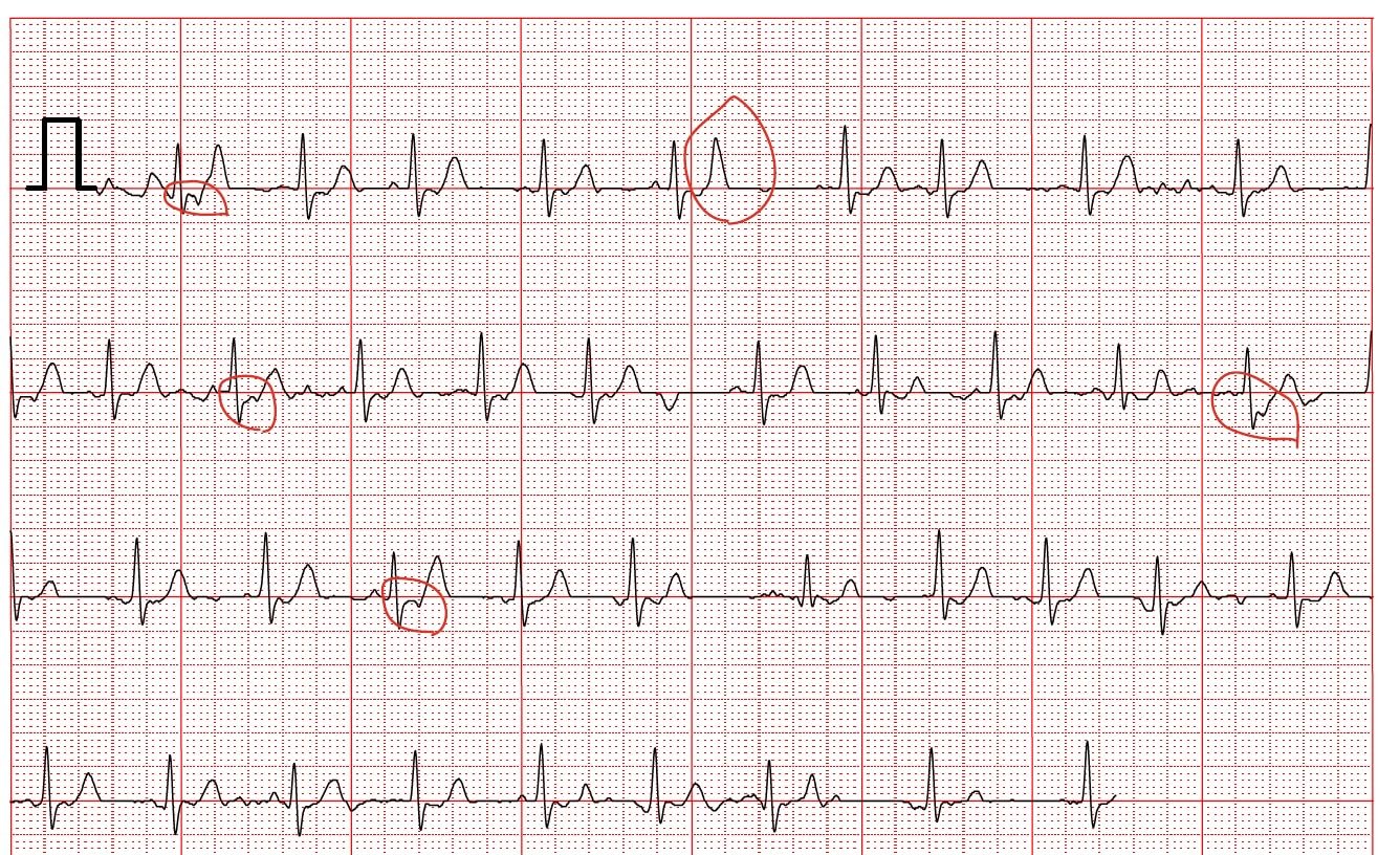 EMAY Portable ECG Monitor | Record ECG and Heart Rate | Compatible with Smartphone and PC customer photo 1