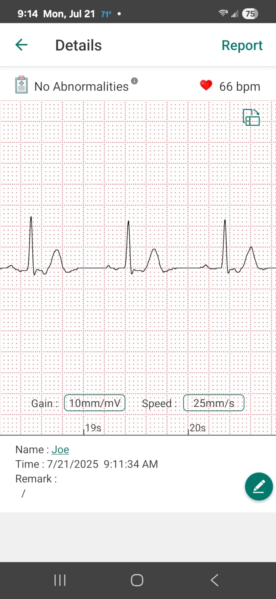 EMAY Portable ECG Monitor | Record ECG and Heart Rate | Compatible with Smartphone and PC customer photo 2