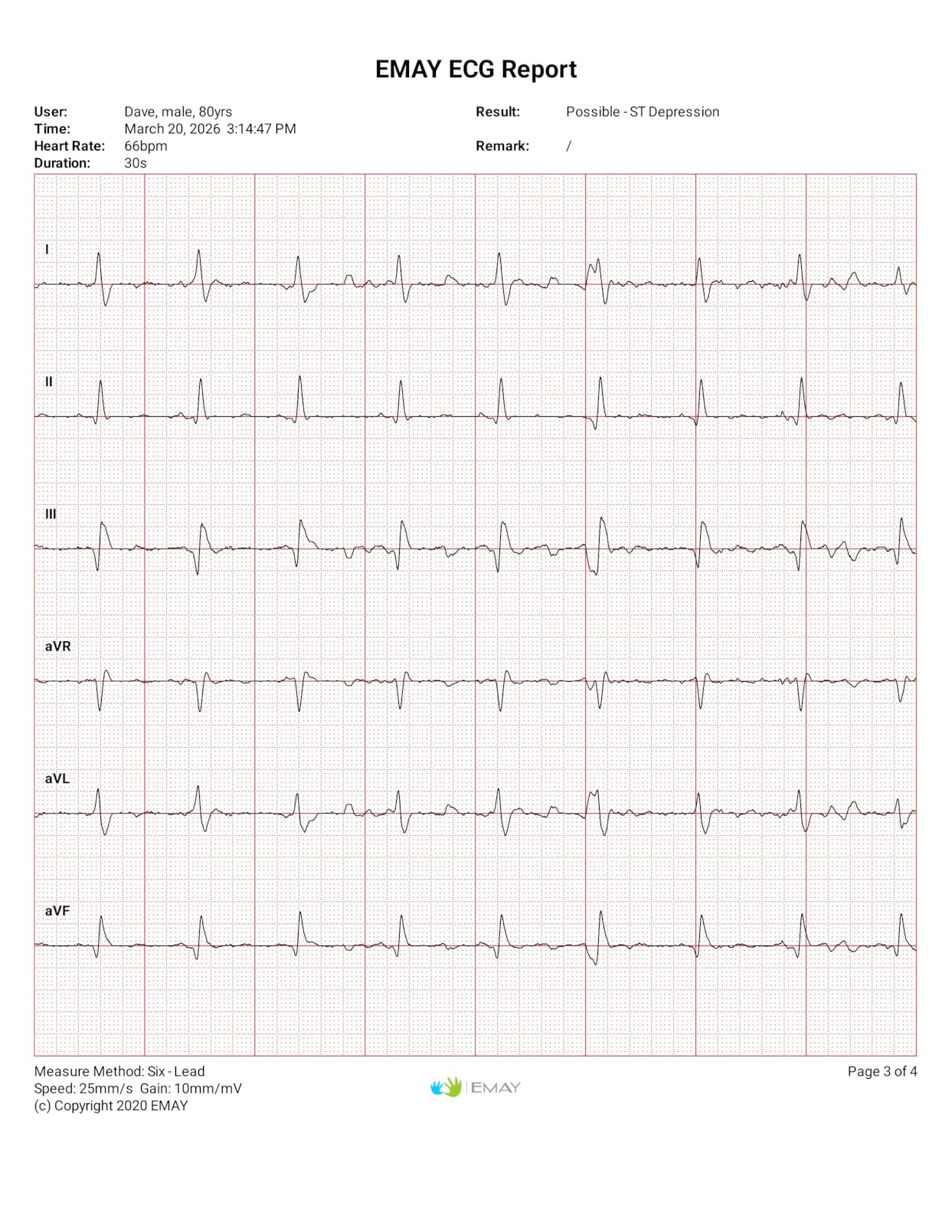 EMAY 6L Portable ECG Monitor | Record ECG and Heart Rate in 6 Channels | Compatible with Smartphone and PC | No Subscription Required customer photo 2
