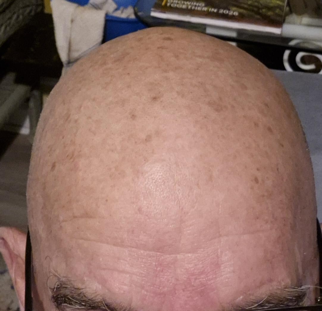 Philips Norelco Shaver 3600 Series, Wet and Dry Electric Shaver, P-Cap, Travel Pouch, Storm Blue, Model S3243/91 customer photo 1