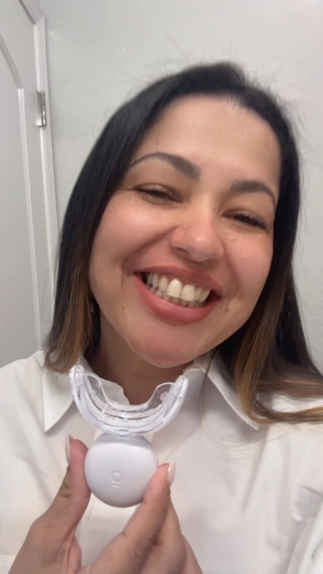 Auraglow Plug-in LED Teeth Whitening Kit - Wired Light Device - 35% Carbamide Peroxide Gel customer photo 2