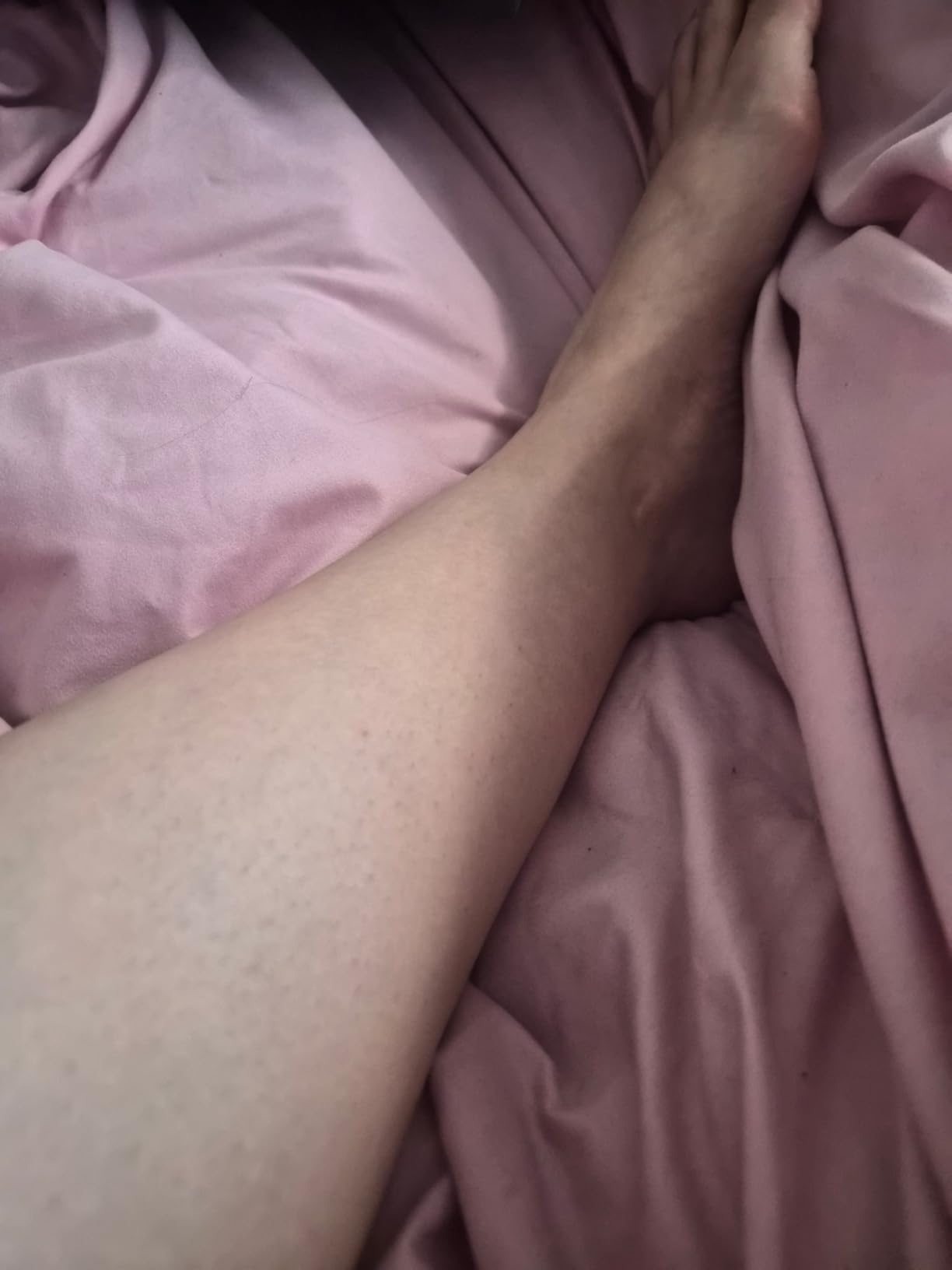 Laser Hair Removal, BoSidin IPL Hair Removal with Painless Ice-Cooling, 2-in-1 Face SR Rejuvenation, 6+1 Modes, 6 Levels Hair Removal for Women Permanent, Laser Hair Removal Kit with Shaver, Goggles customer photo 2