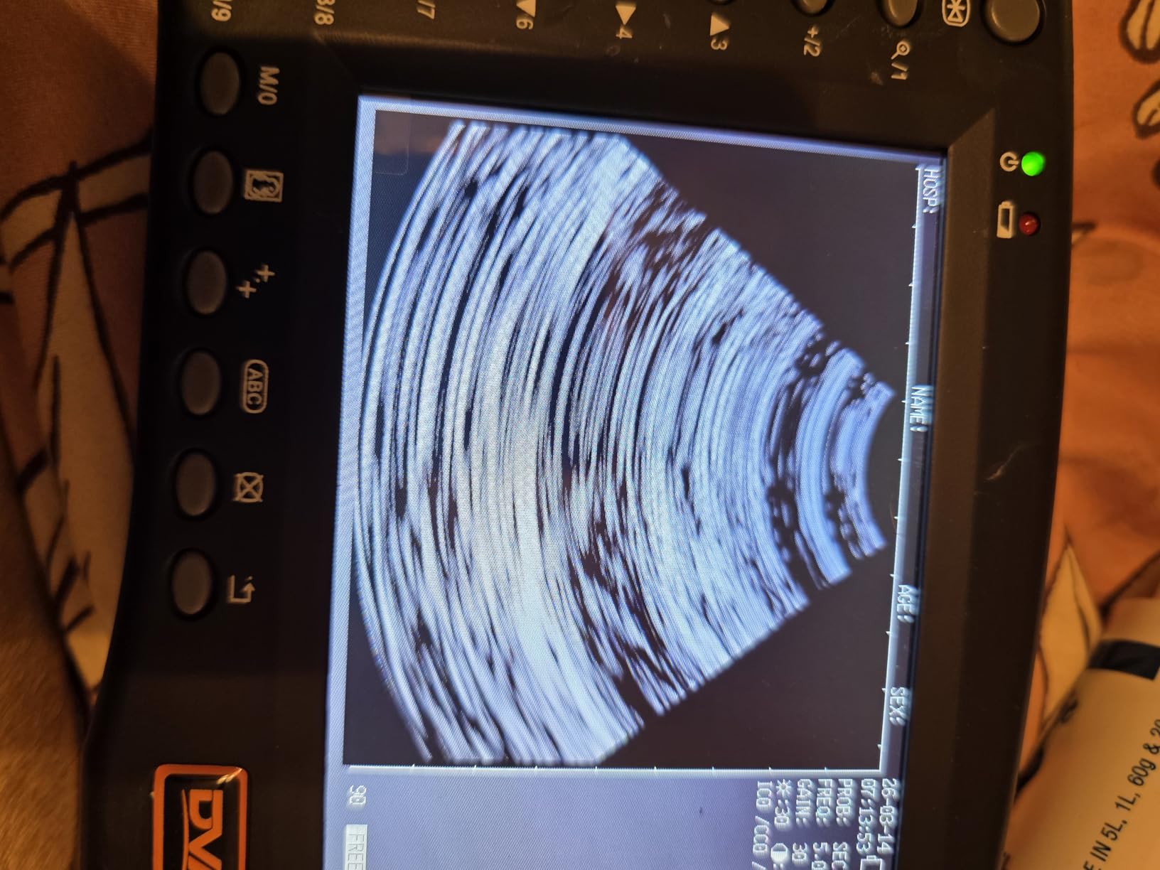 Portable Ultrasound Machine for Pregnancy - Digital Sonogram Machine with 3.5 MHz Probe and 8-Color Panels - Perfect for Sheep, Dogs, Cats, and Pigs Pregnancy Testing customer photo 2