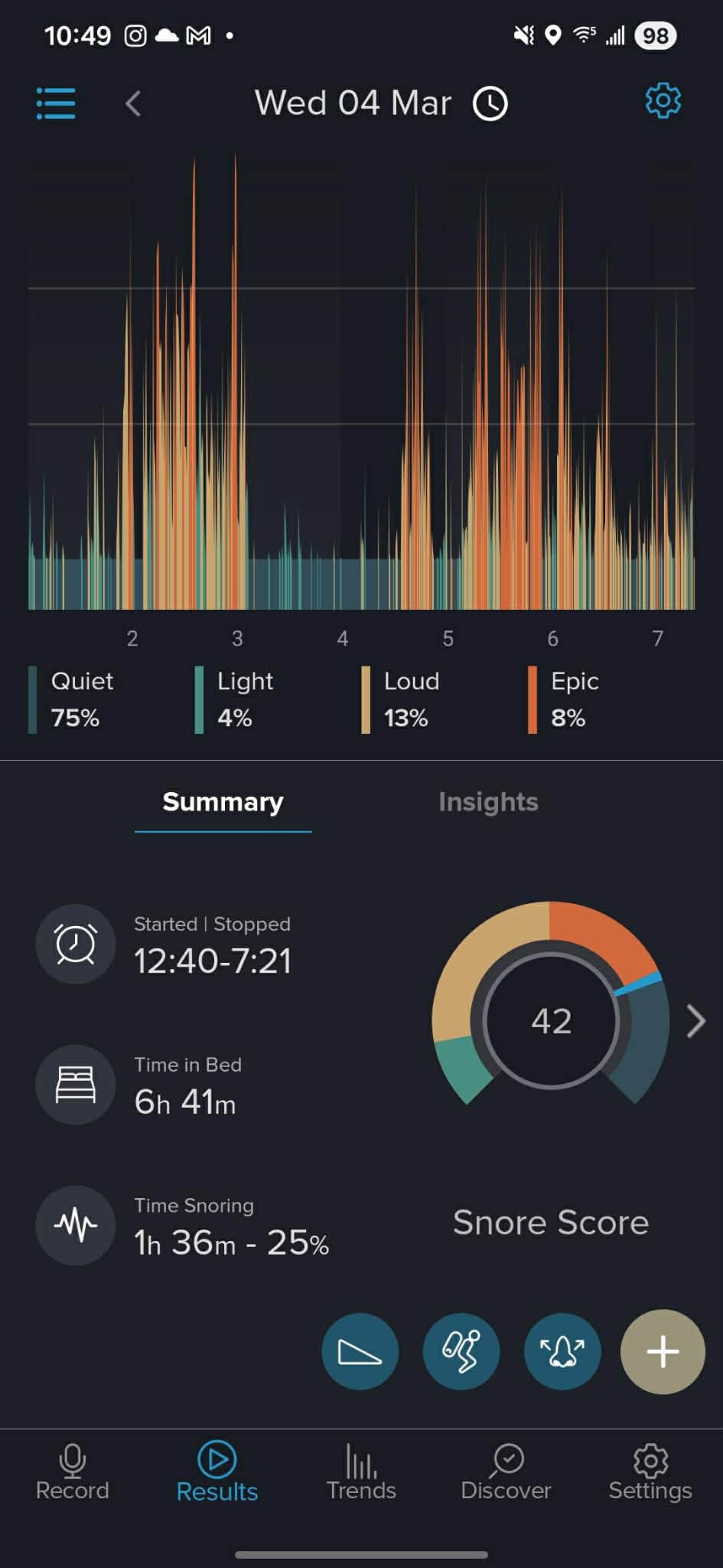 Somnofit-S Anti-Snore Mouth Guard by SnoreLessNow | Made in Switzerland | FDA Cleared | Most Comfortable Anti Snoring Mouthpiece | Sleep Tight Mouth Guard | Adjustable Snoring Solution for Men & Women customer photo 1