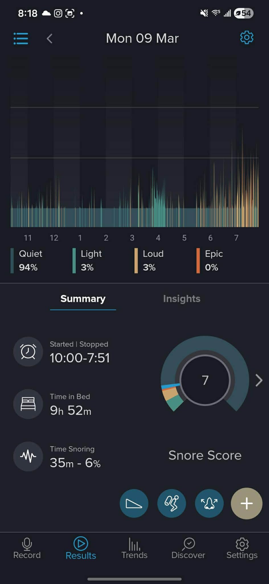 Somnofit-S Anti-Snore Mouth Guard by SnoreLessNow | Made in Switzerland | FDA Cleared | Most Comfortable Anti Snoring Mouthpiece | Sleep Tight Mouth Guard | Adjustable Snoring Solution for Men & Women customer photo 2