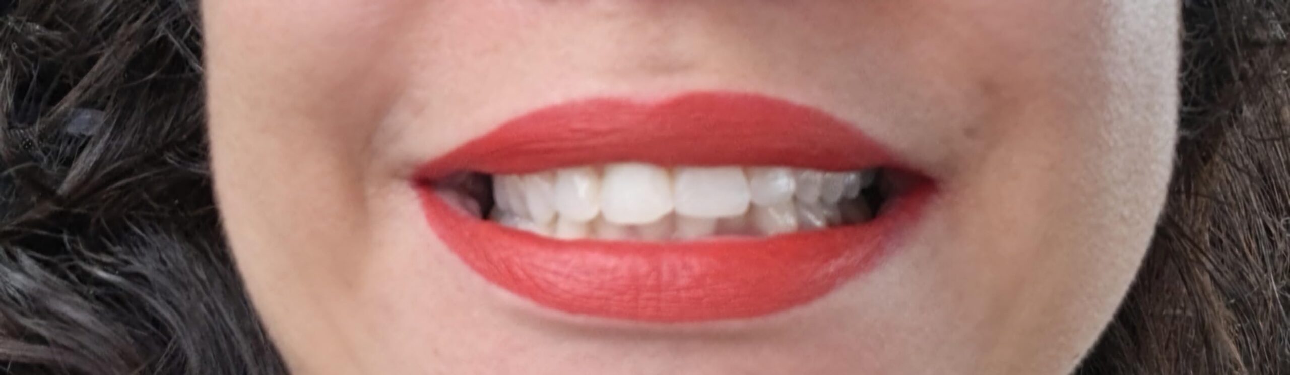 MySmile Teeth Whitening Kit with LED Light, 10 Min Fast Teeth Whitener with 3 x 35% Carbamide Peroxide customer photo 1