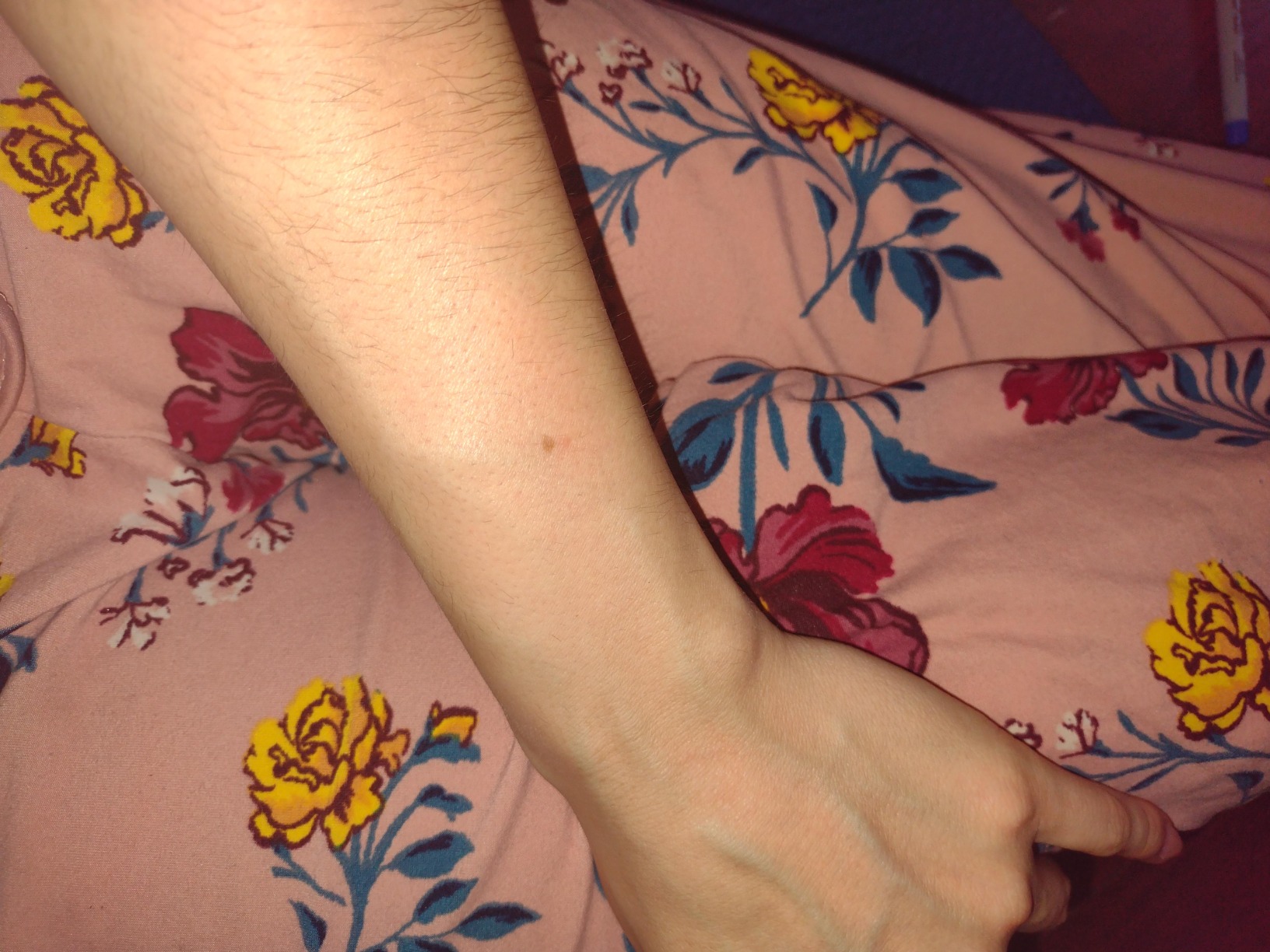 Xsoul Hair Removal with Cooling, Painless IPL Hair Removal Device for Women and Men, at-home Hair Remover for Armpits, Legs, Face, and Bikini Line customer photo 2