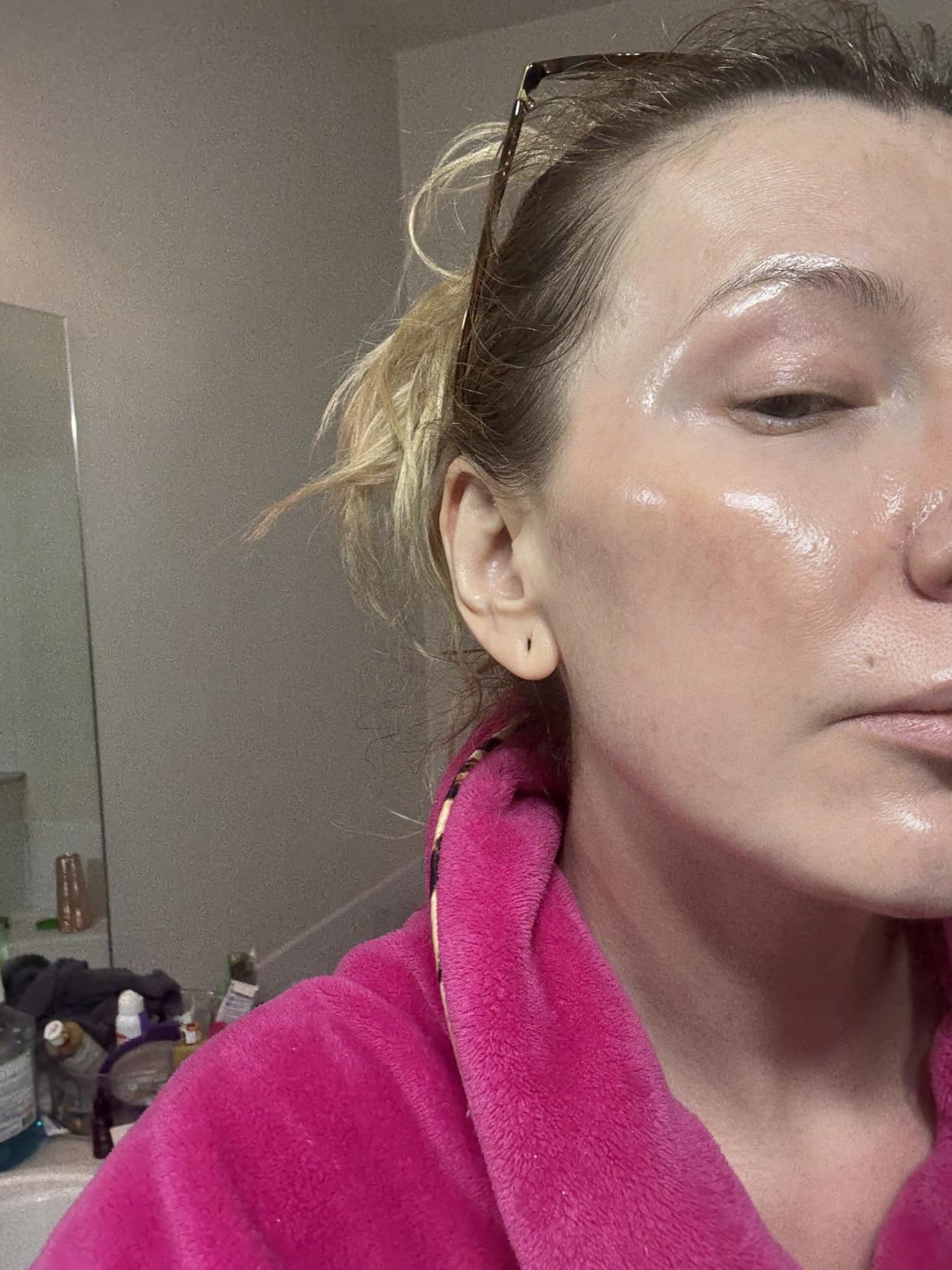 Microneedle Roller Pen for Home Use - Microneeding Derma Roller Pen for Women Men - Micro Needle Roller Pen for Skin Tools-0.24MM customer photo 2