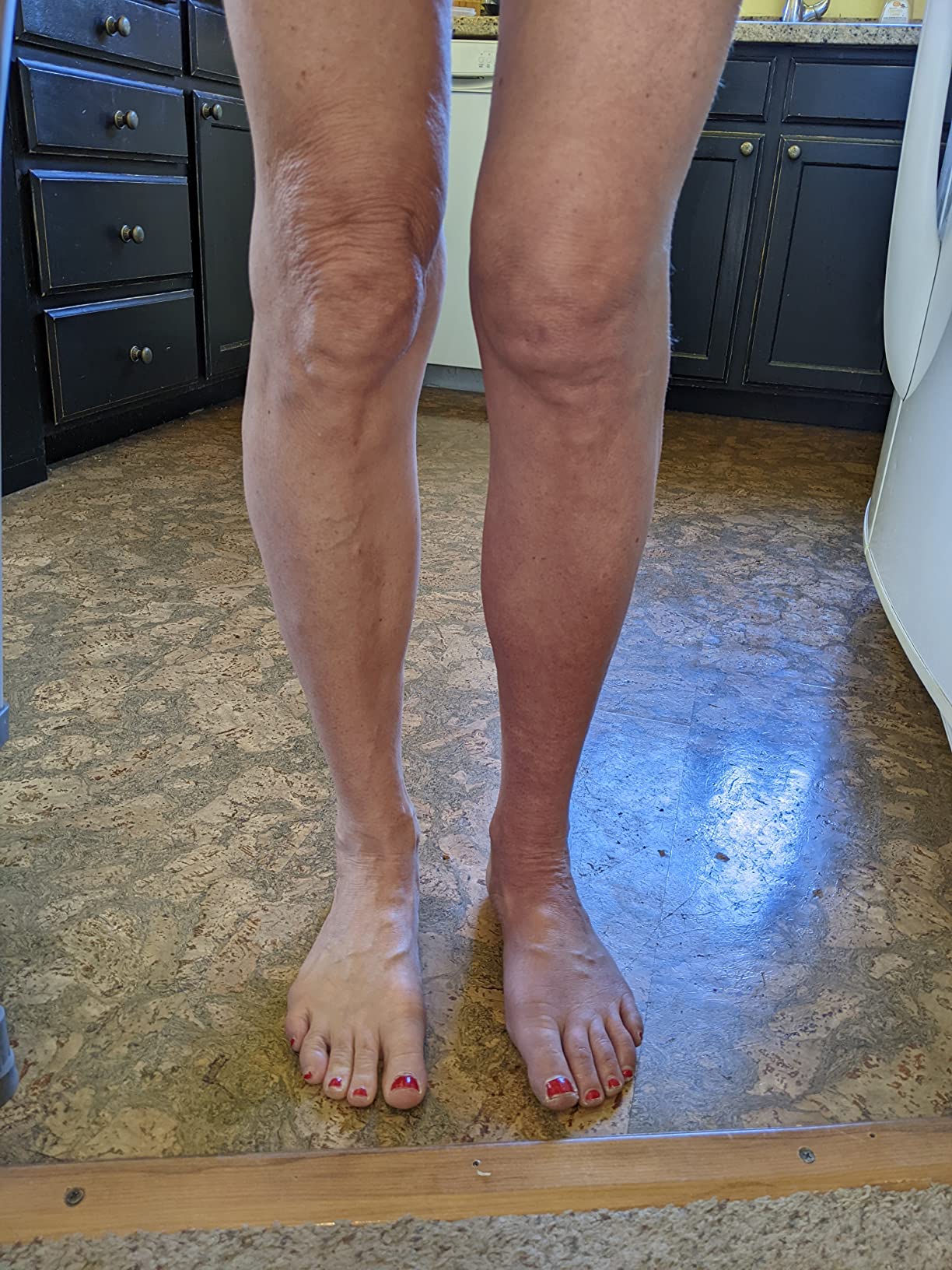 Therabody JetBoots Prime - Ultra-Portable, Wireless Compression Boots for Easy Leg Muscle Recovery - Calf, Leg & Thigh Compression Sleeve with Customizable Treatments (Short) customer photo 1