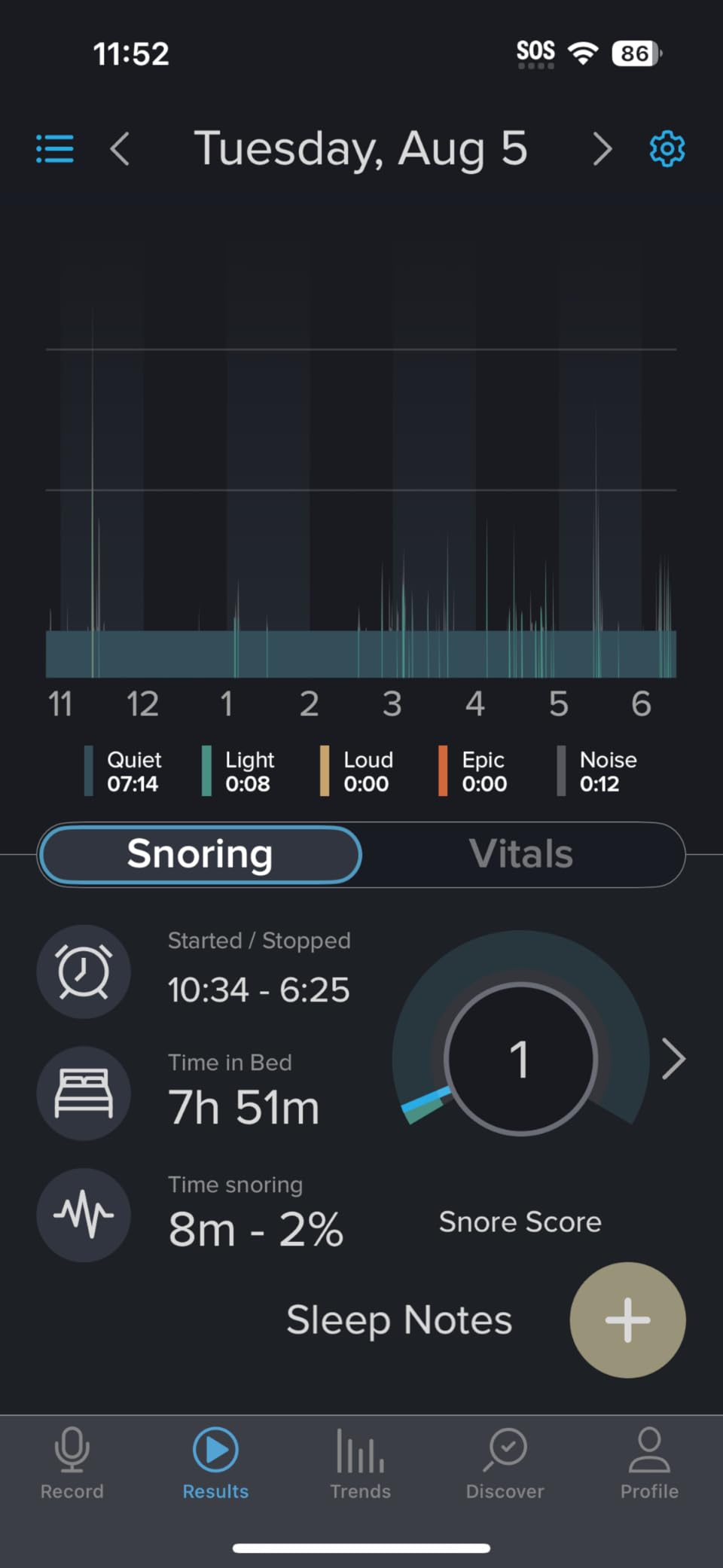 The Original Anti-Snoring Pillow for Side Sleepers, Snoring Solution and Remedy, Patent-Pending Stop Snore Aid with Memory Foam, Snore Stopper, Anti-Snore Pillow, Anti-Snore Devices customer photo 1