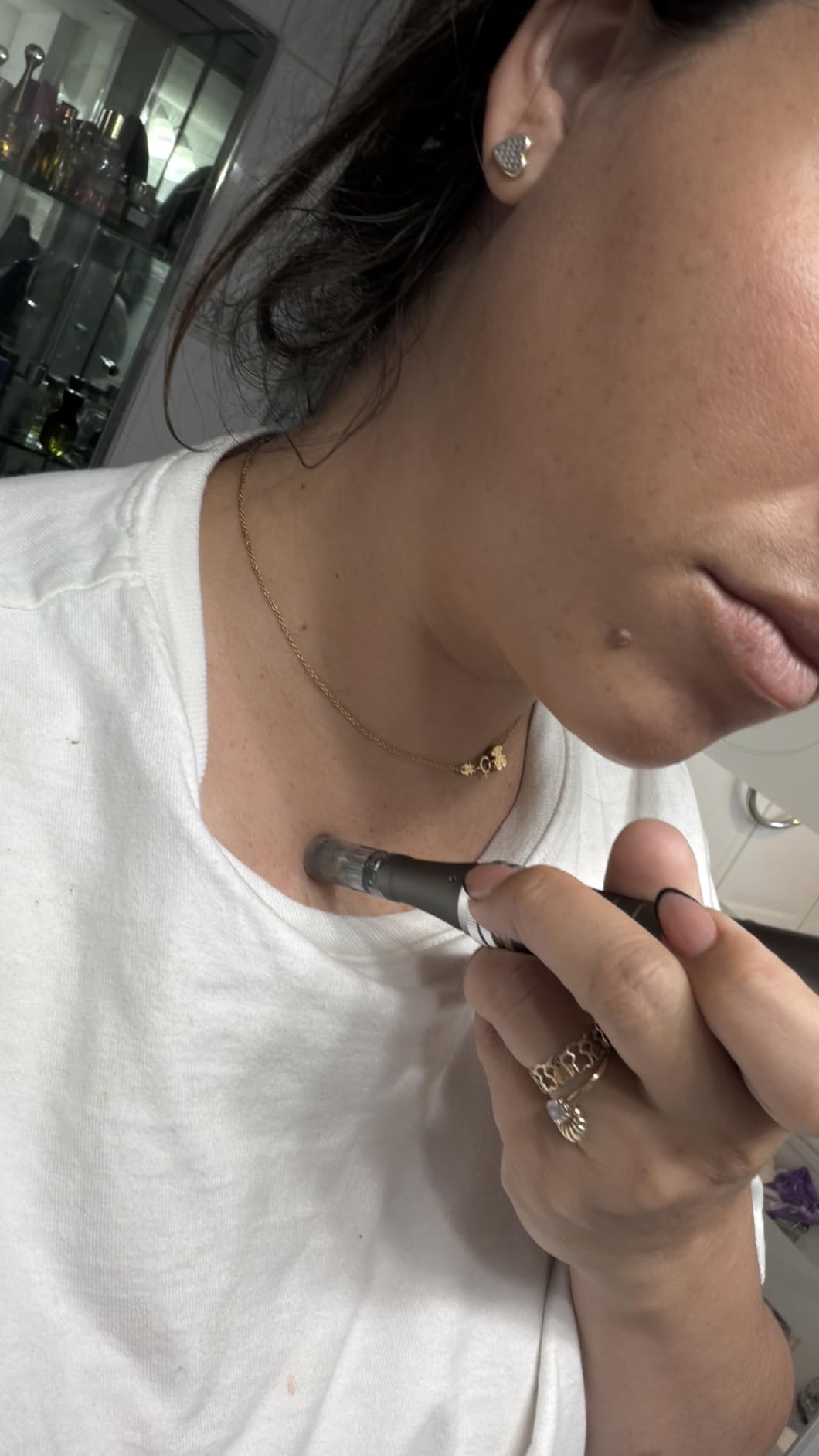 DermaStamp System 0.25mm, Microneedling Stamp Pen, Derma Stamp Pen, Derma Roller Alternative, Microneedle Micro Needle Skin Care for Men Women customer photo 2