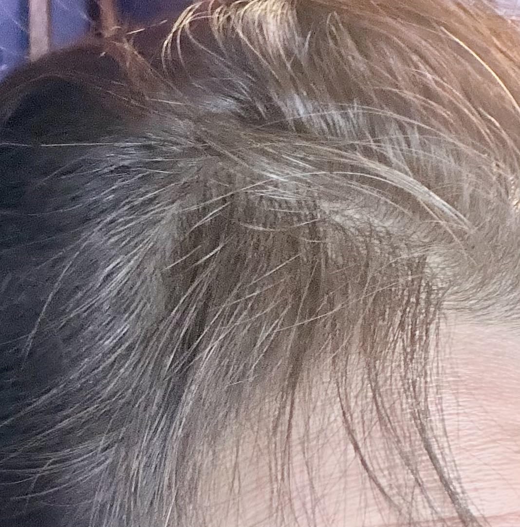 Laser Hair Growth Cap，Red Light theray for Hair, Deep Black Cap customer photo 1