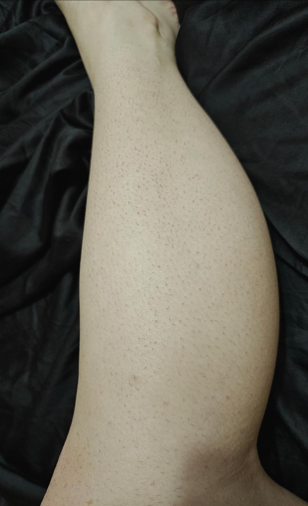 Philips Lumea 8000 Series IPL Hair Removal Device, Permanent Laser Hair Reduction for Women & Men, Easy and Comfortable Use at Home, SenseIQ, 3 Attachments for Body, Face, Intimate, BRI937/03 customer photo 1